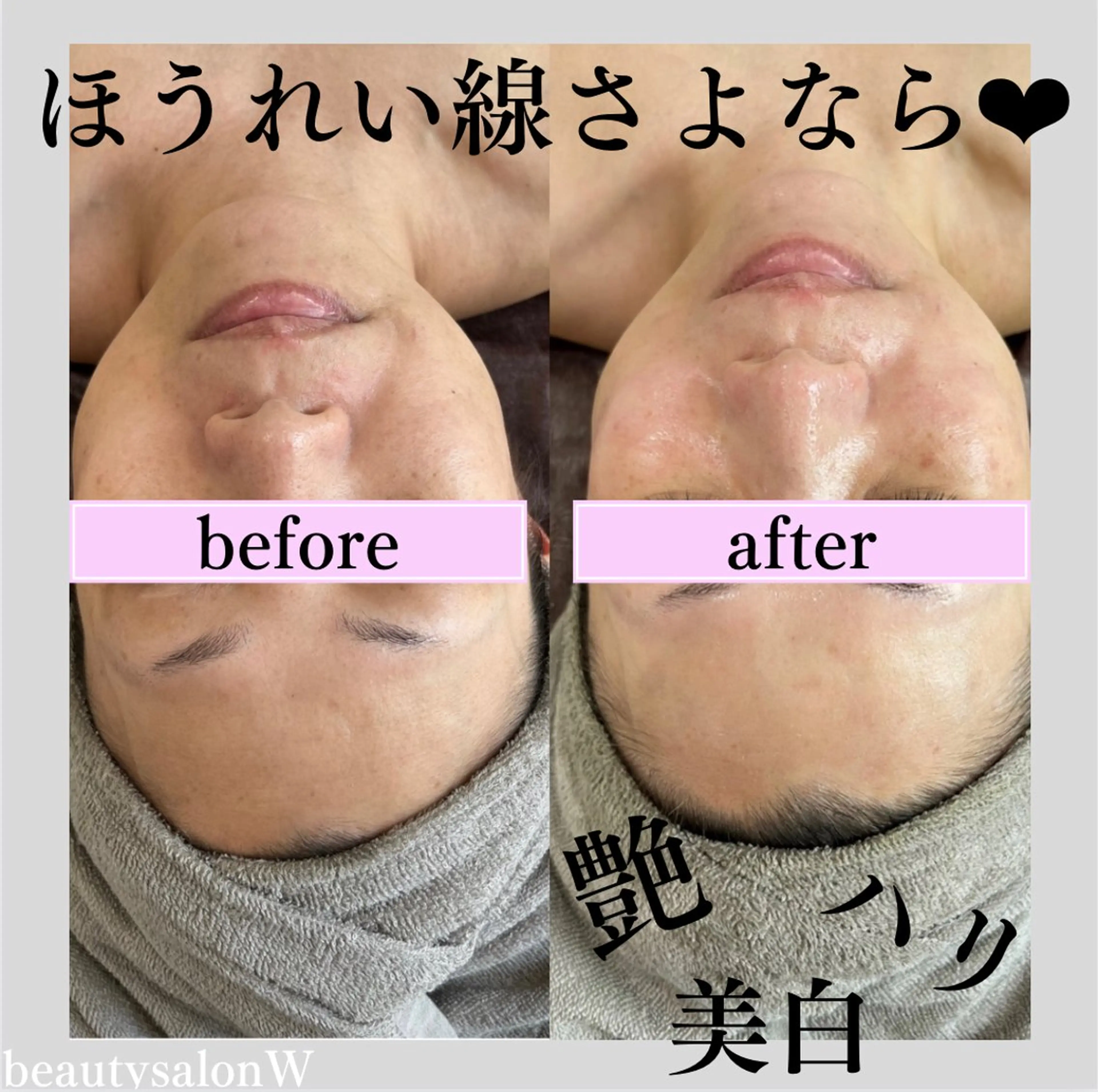 エステ リラク beautysalonW所属・beauty salonWのエステ・リラクイメージ