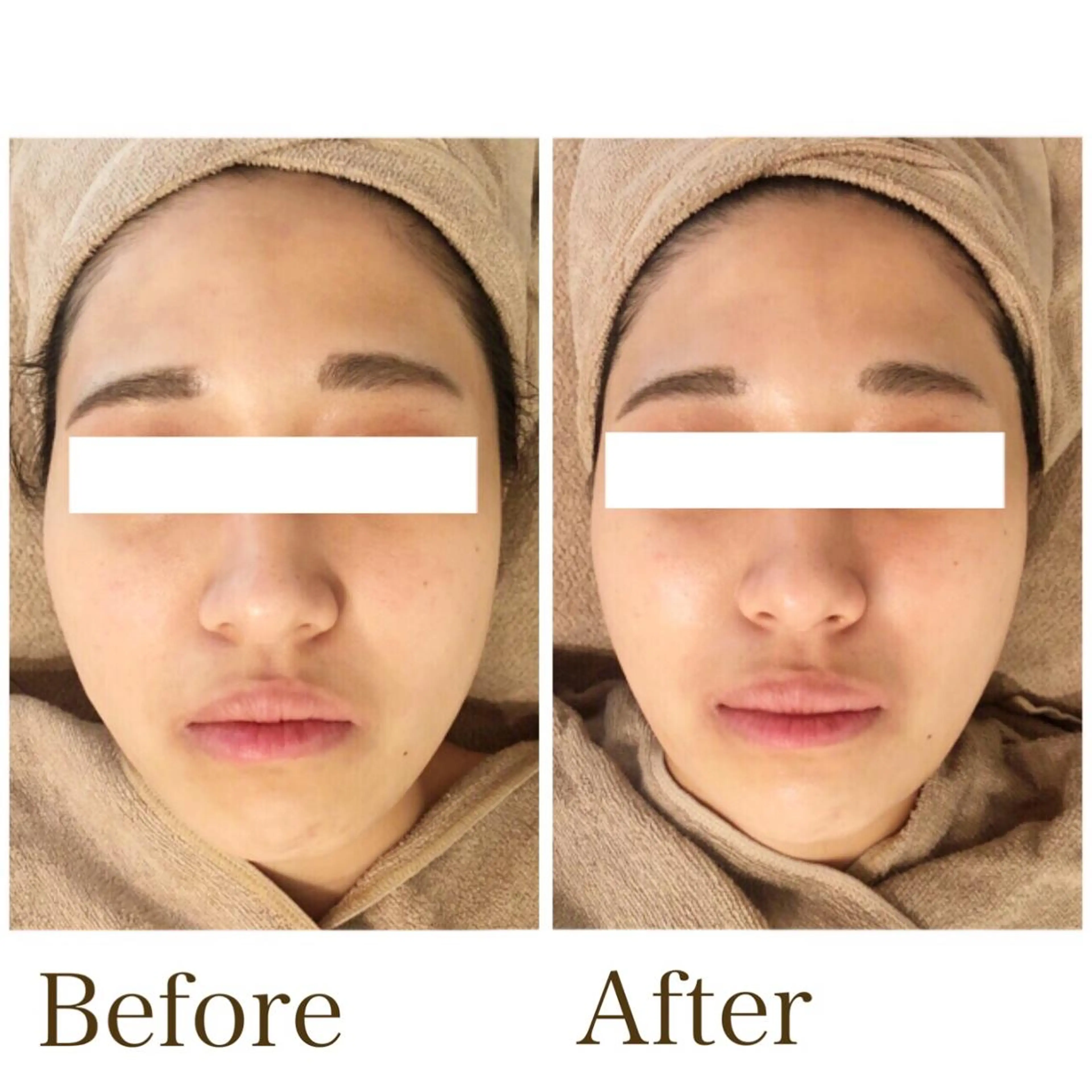 エステ MiMiy 銀座店のエステ・リラクイメージ