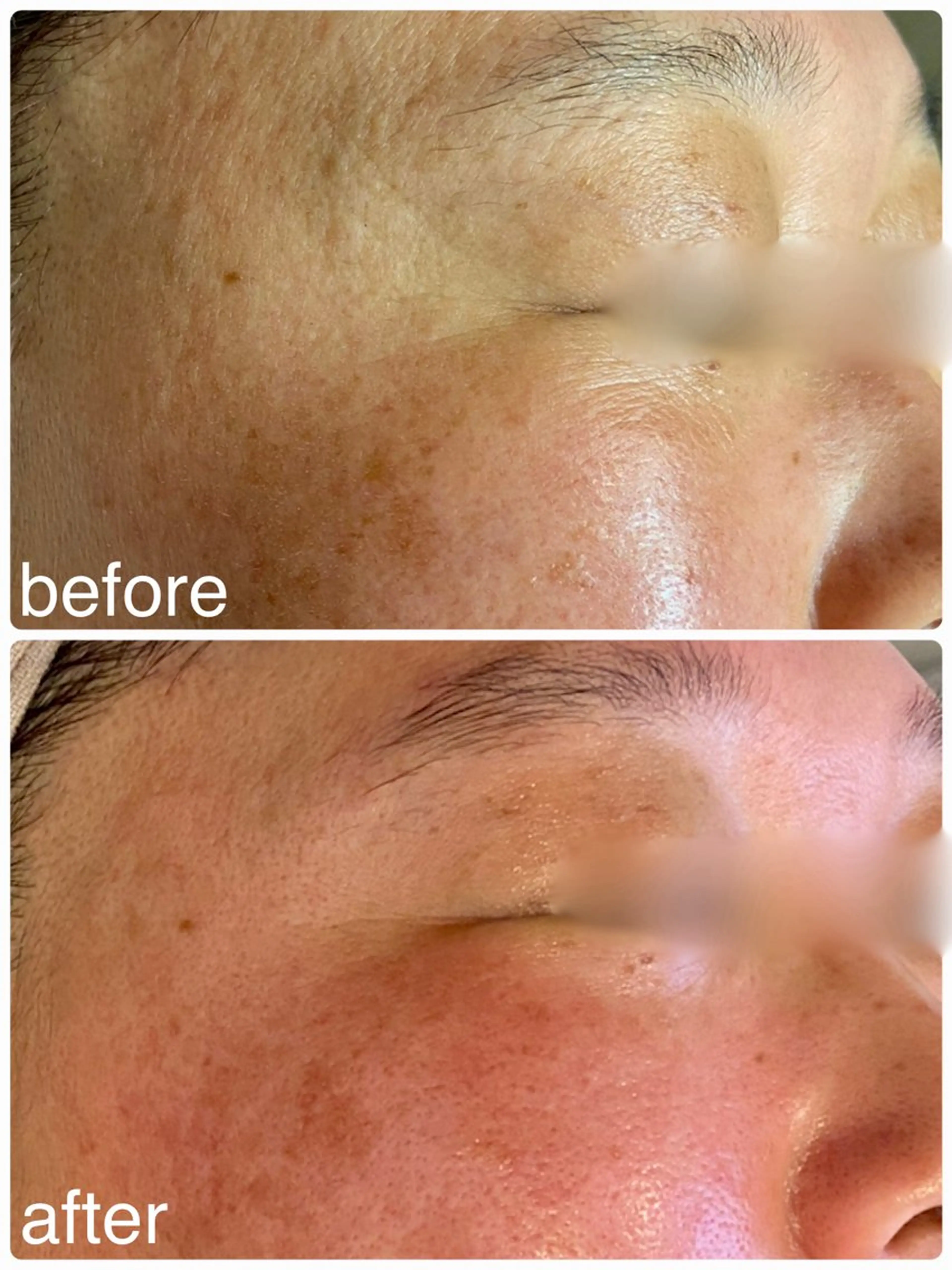 エステ Hisui 小出のエステ・リラクイメージ