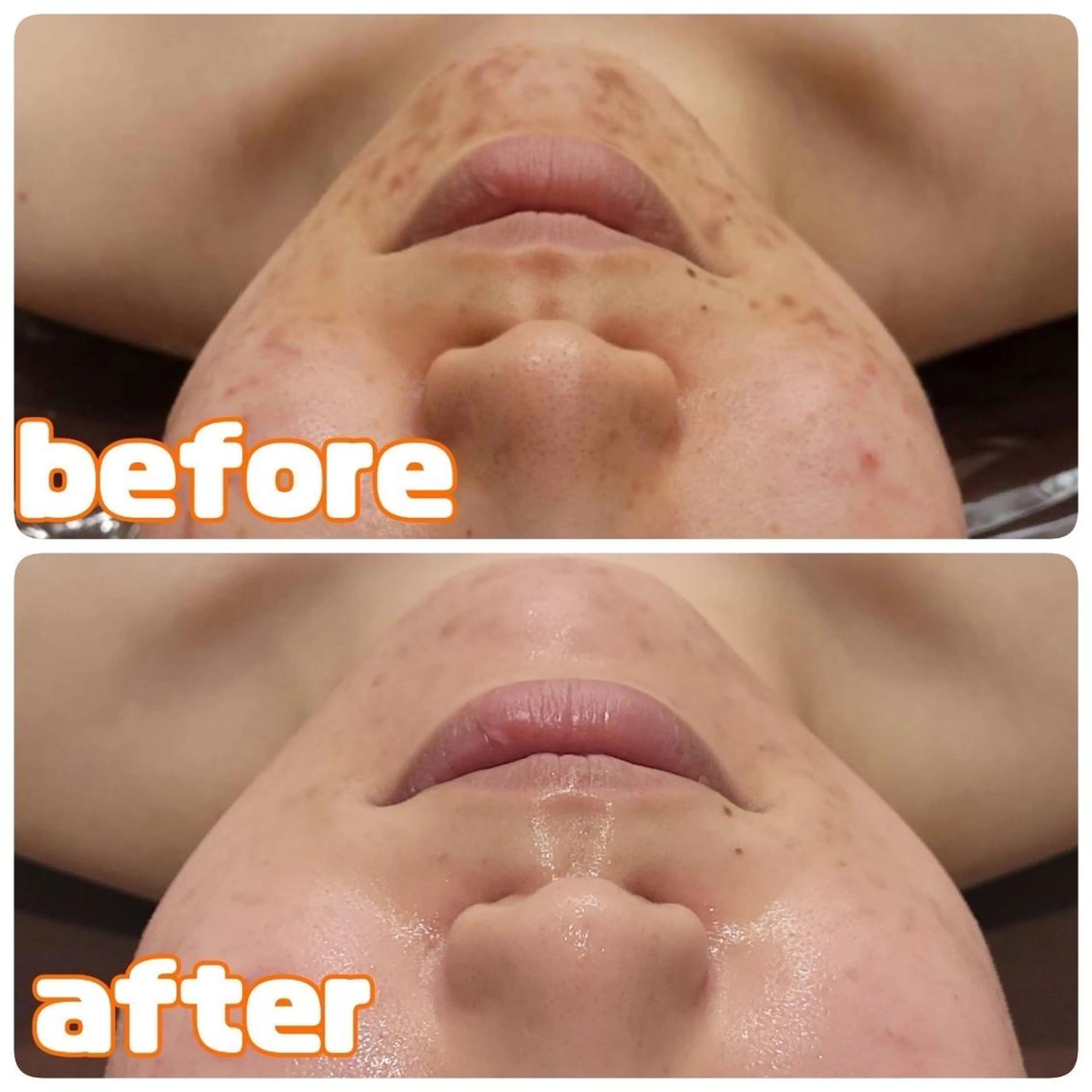 レイビス名古屋♡ 伊波のエステ・リラクイメージ