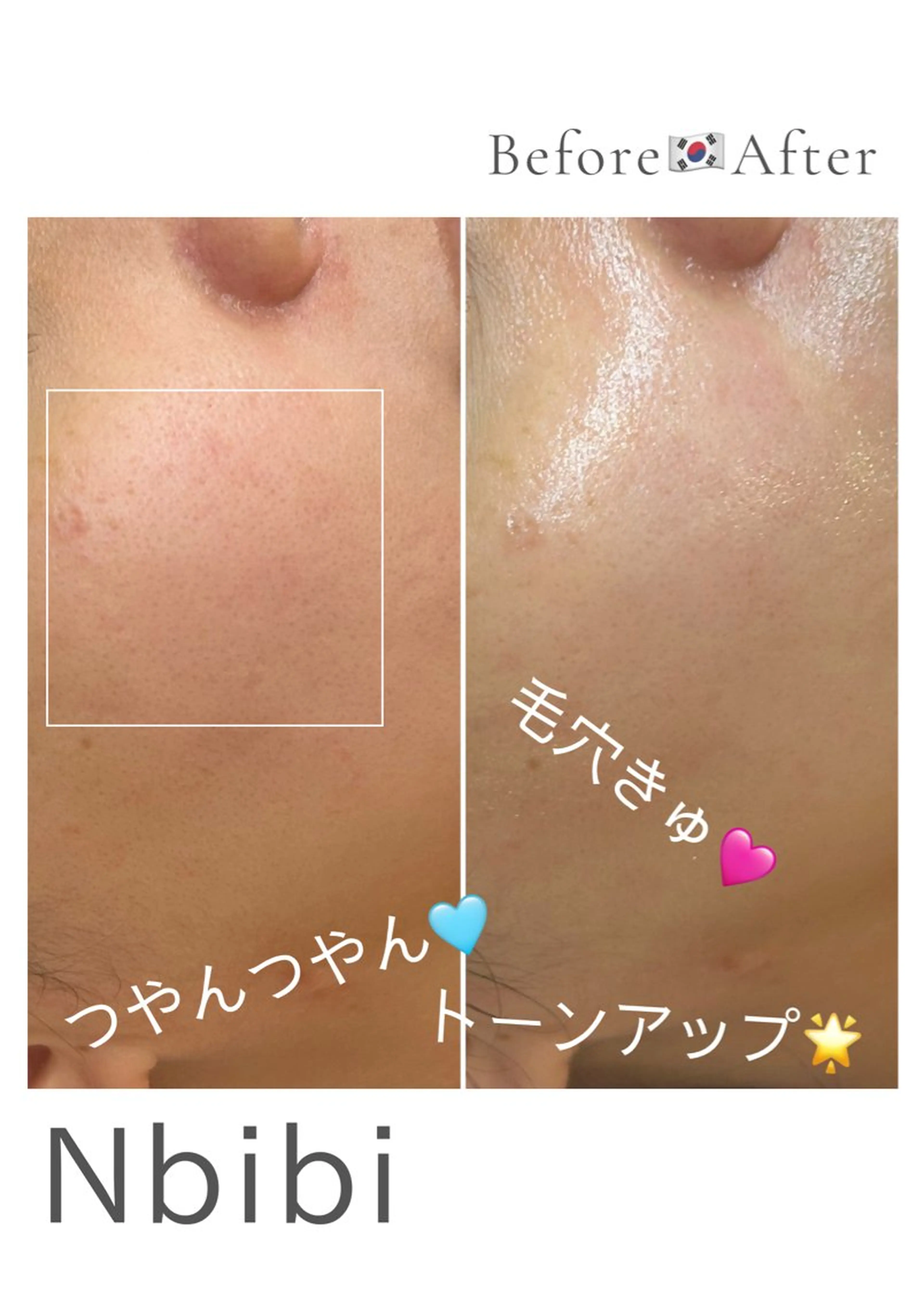 韓国🇰🇷価格 サロン_Nbibiのエステ・リラクイメージ