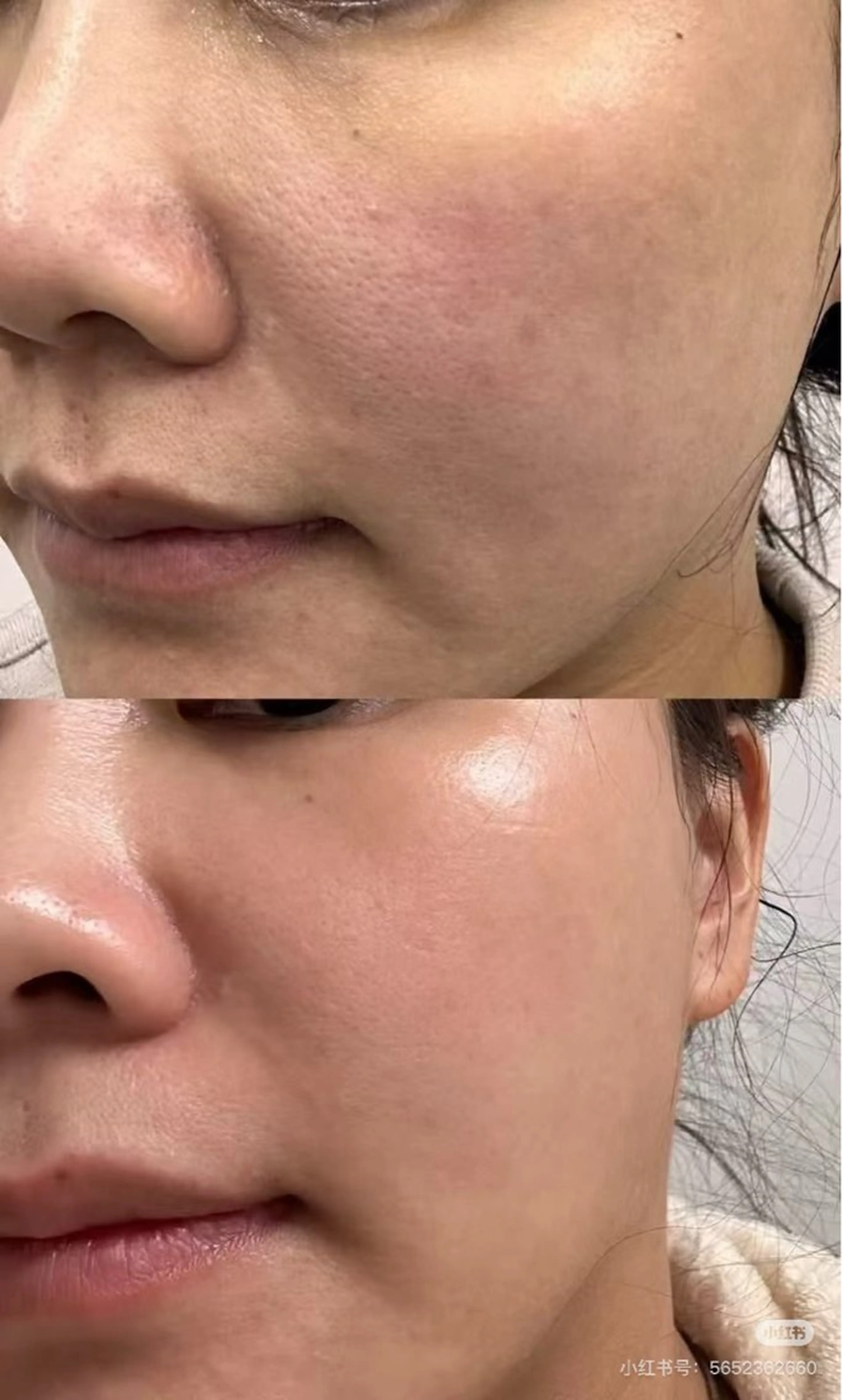 ショート エステ aliaハイフ&水光ジェットサロン所属・aliaハーブ水光店 エステティシャン募集のエステ・リラクイメージ