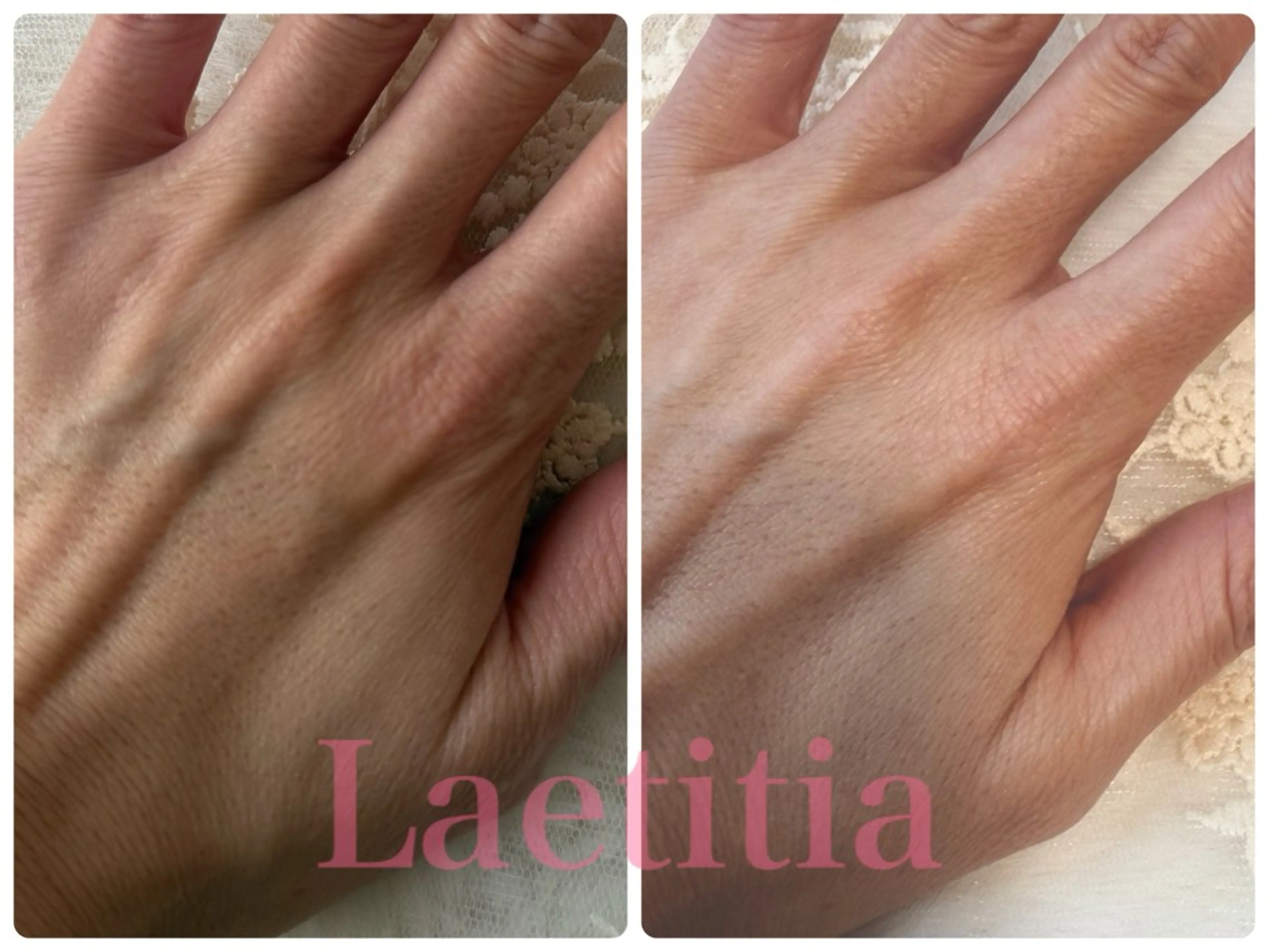 ハンドケア レティティア【Laetitia】所属・レティティア秋葉原店 Yoshizawaのエステ・リラクイメージ