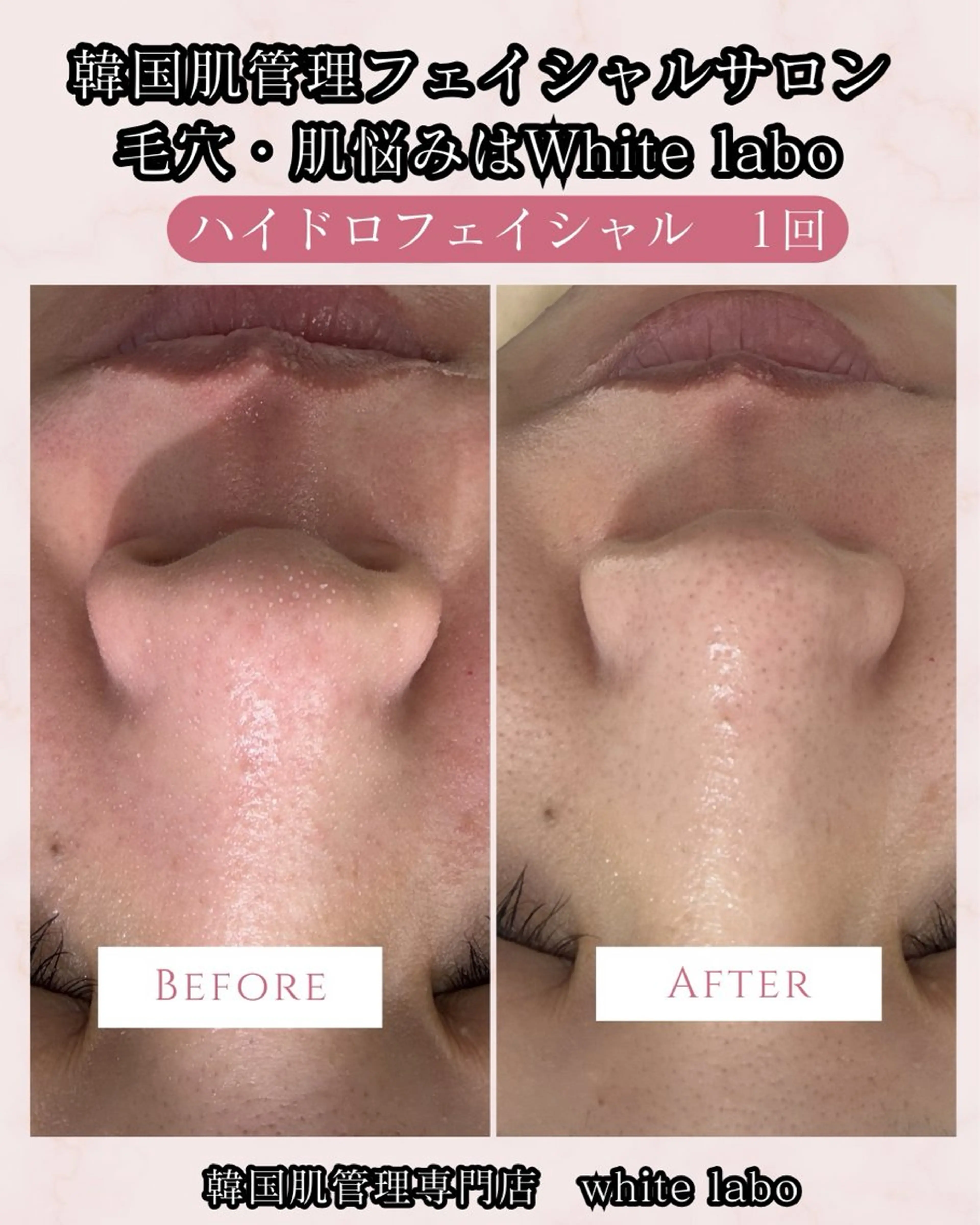 韓国肌管理専門店　White labo 梅田店所属・ホワイトラボ梅田 ｜毛穴・韓国肌管理のエステ・リラクイメージ