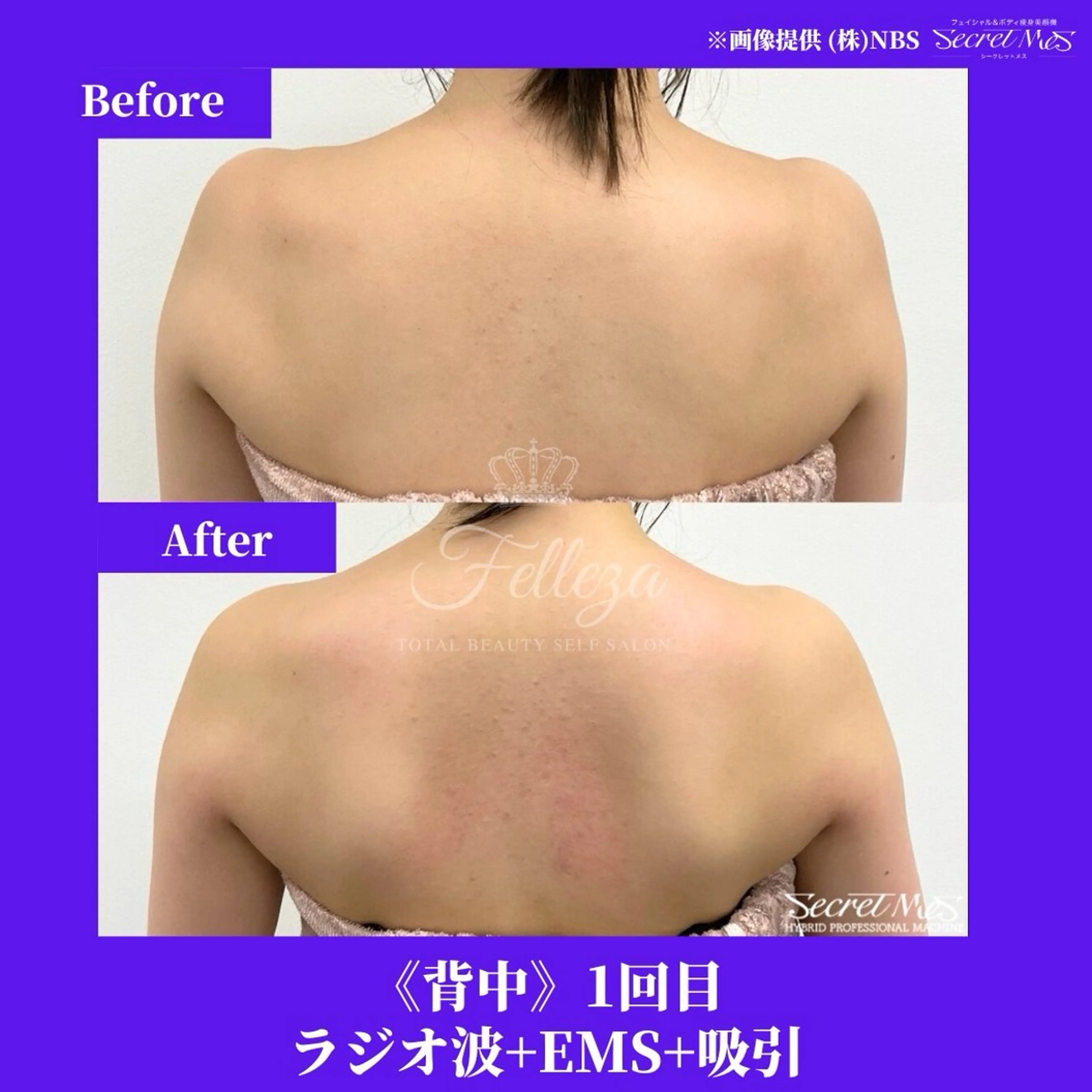 メンズ 有人型セルフサロン 脱毛/痩身/美顔のその他イメージ