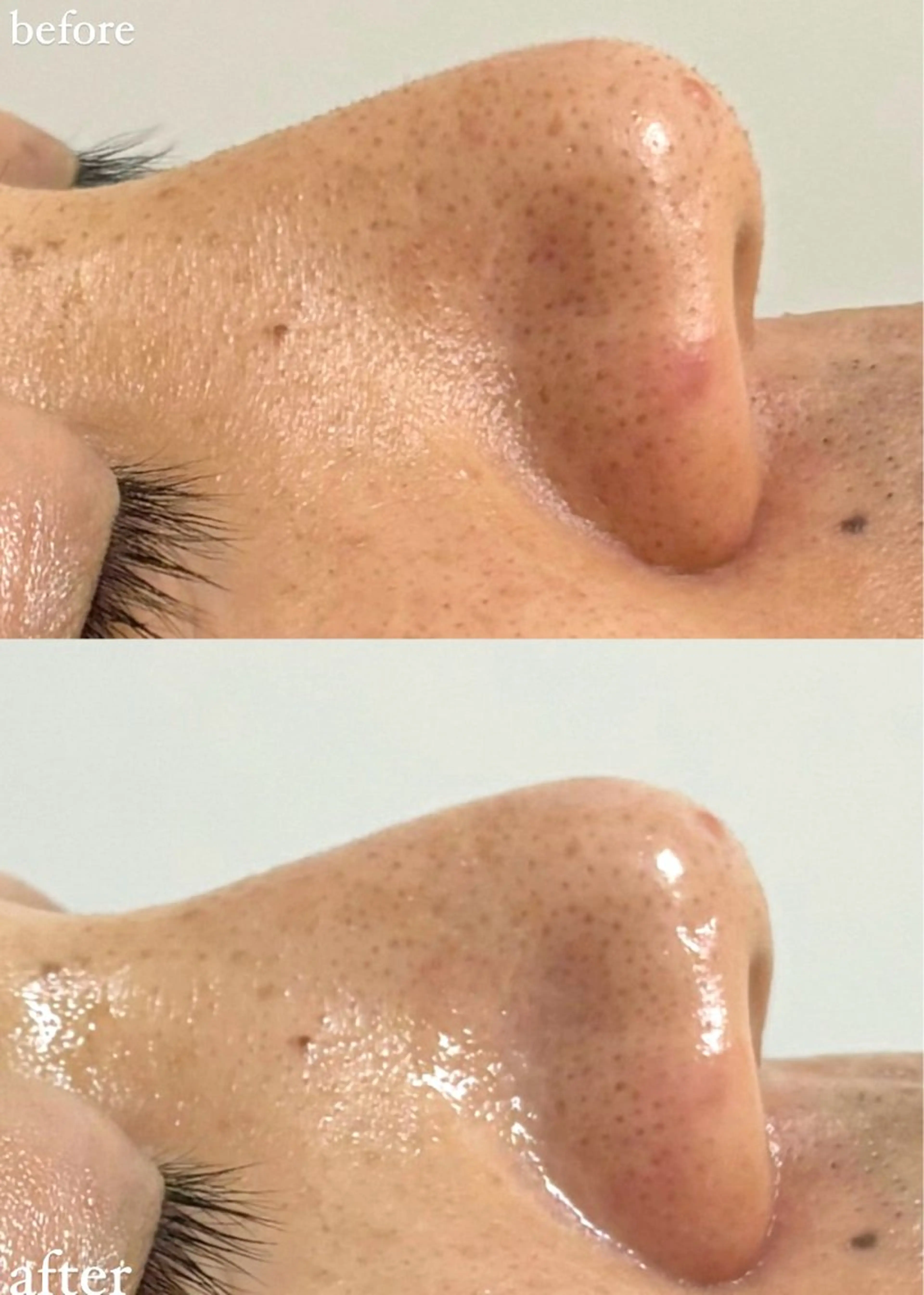 女性専門お顔剃り sunraineのエステ・リラクイメージ