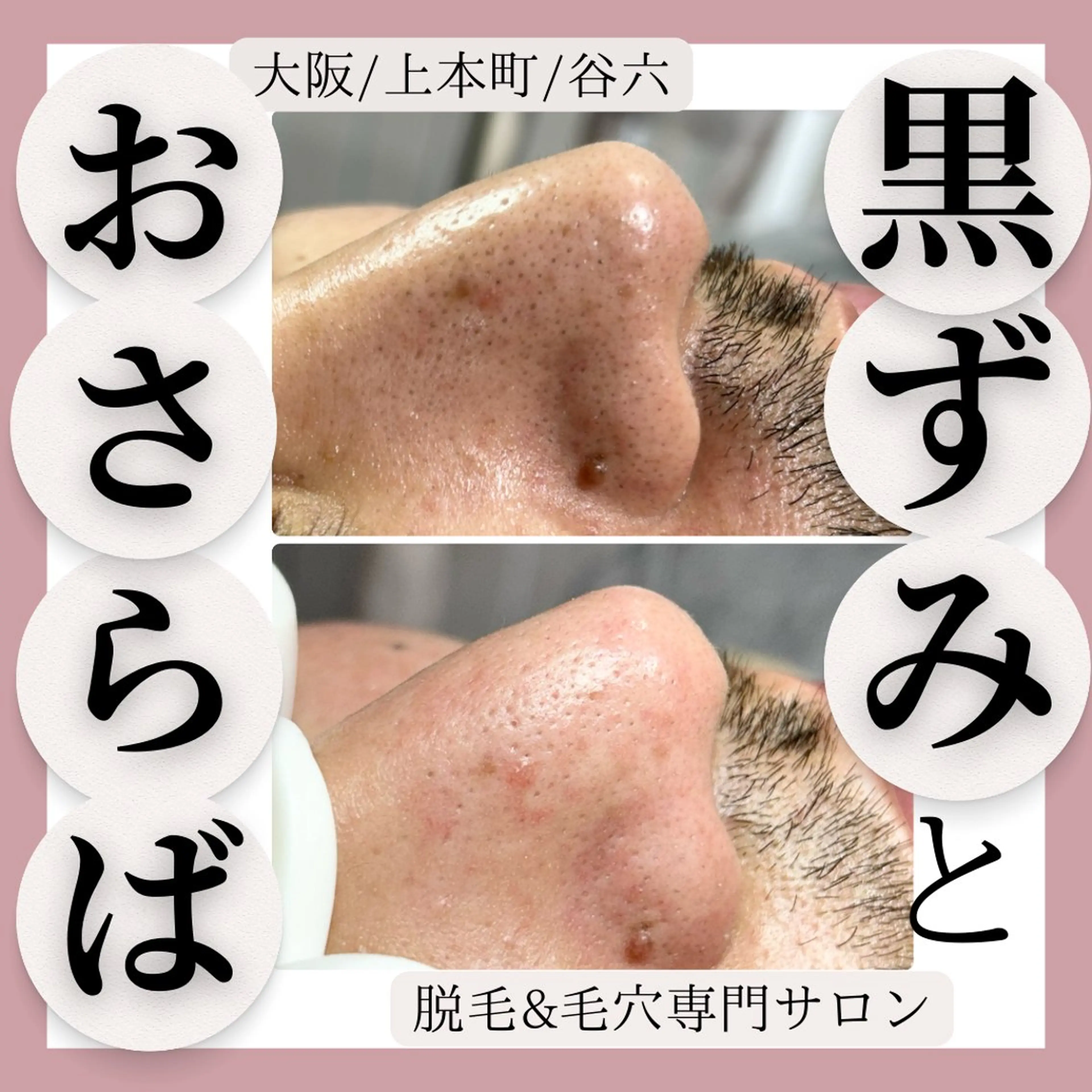 美肌脱毛&毛穴専門 Nico🐰ྀི♡のエステ・リラクイメージ