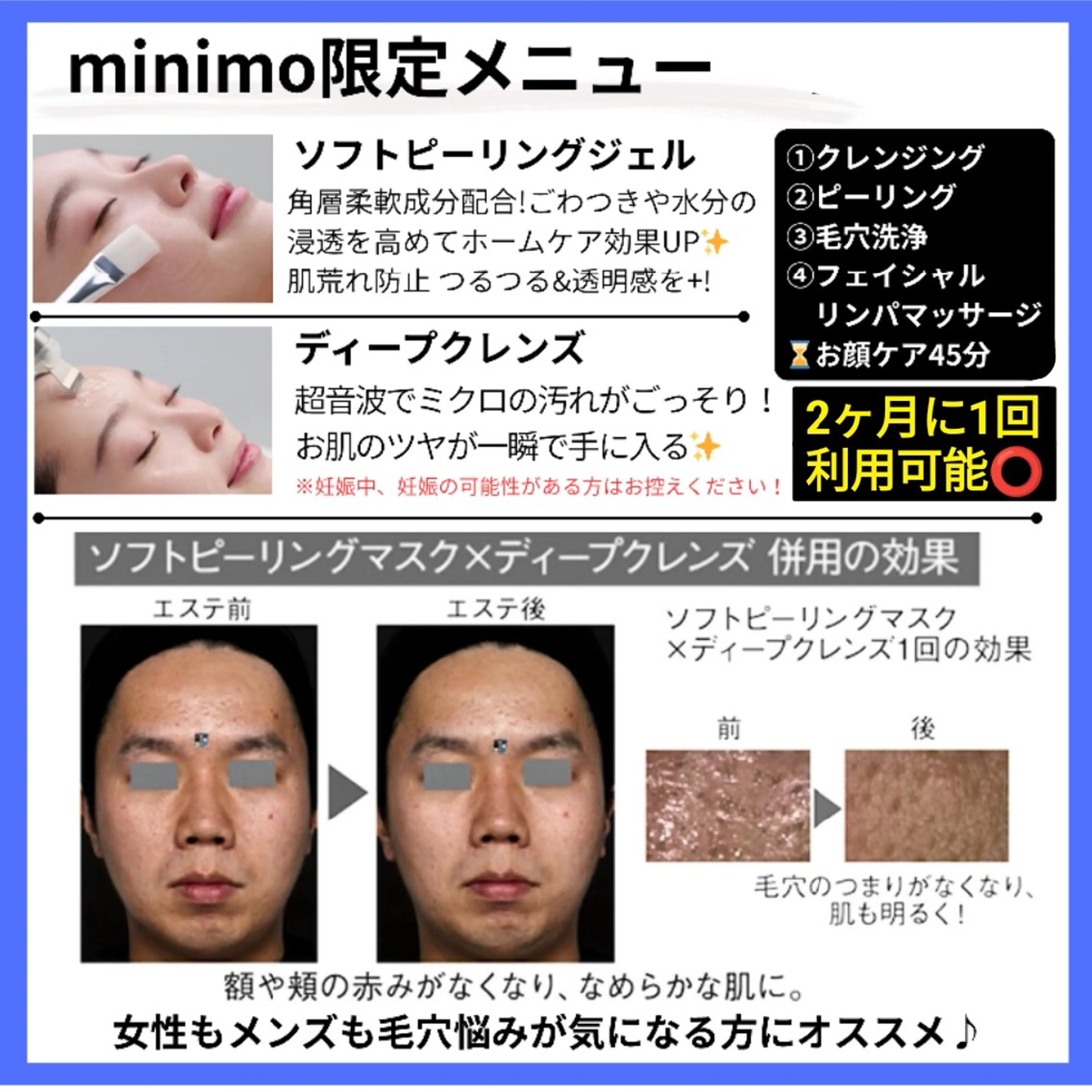 【メンズ限定】洗顔3ヶ月分付き♪毛穴洗浄フェイシャルコース🫧の写真