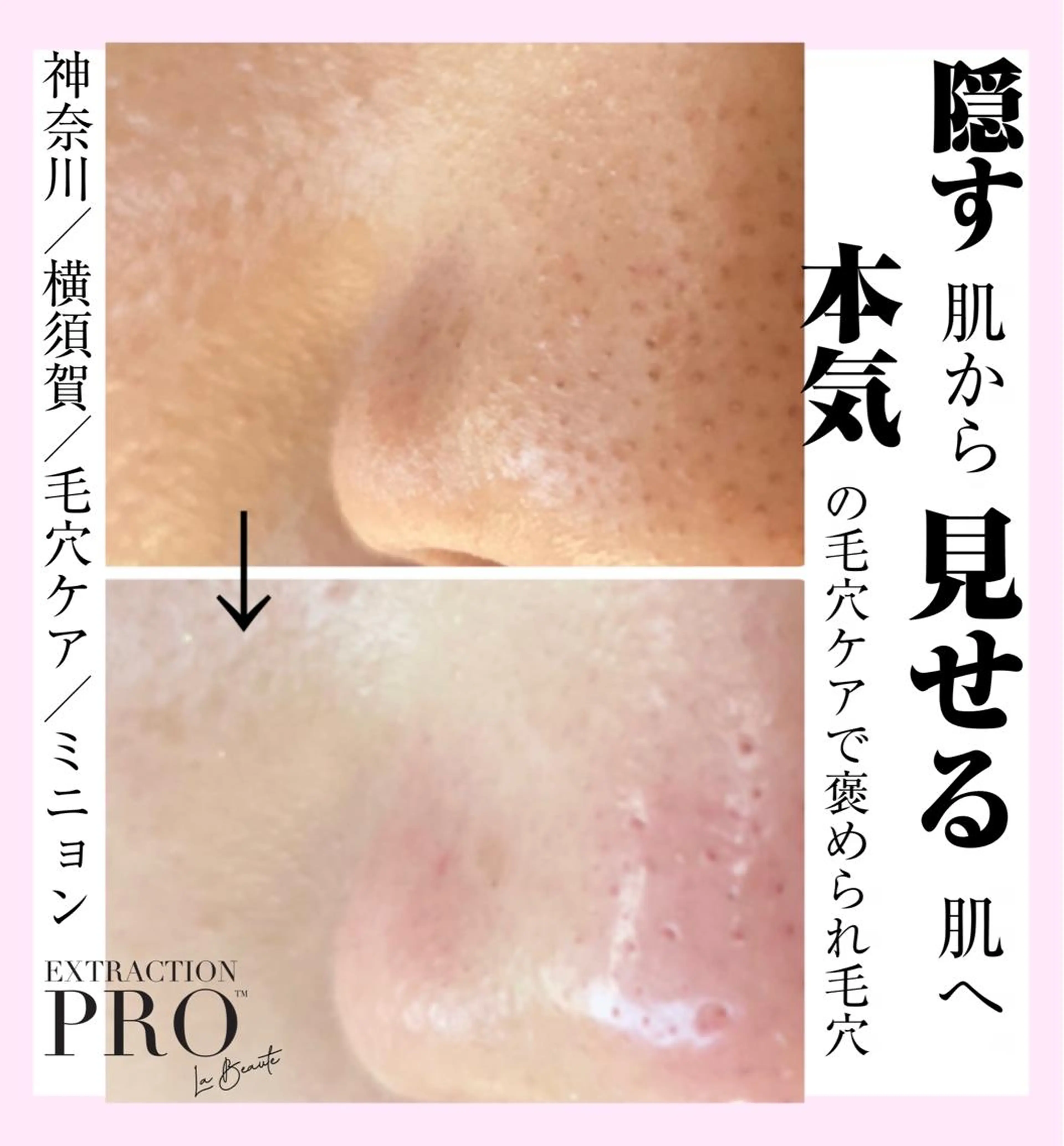 Mignon +所属・Mignon + Natsukiのマツエク・マツパデザイン