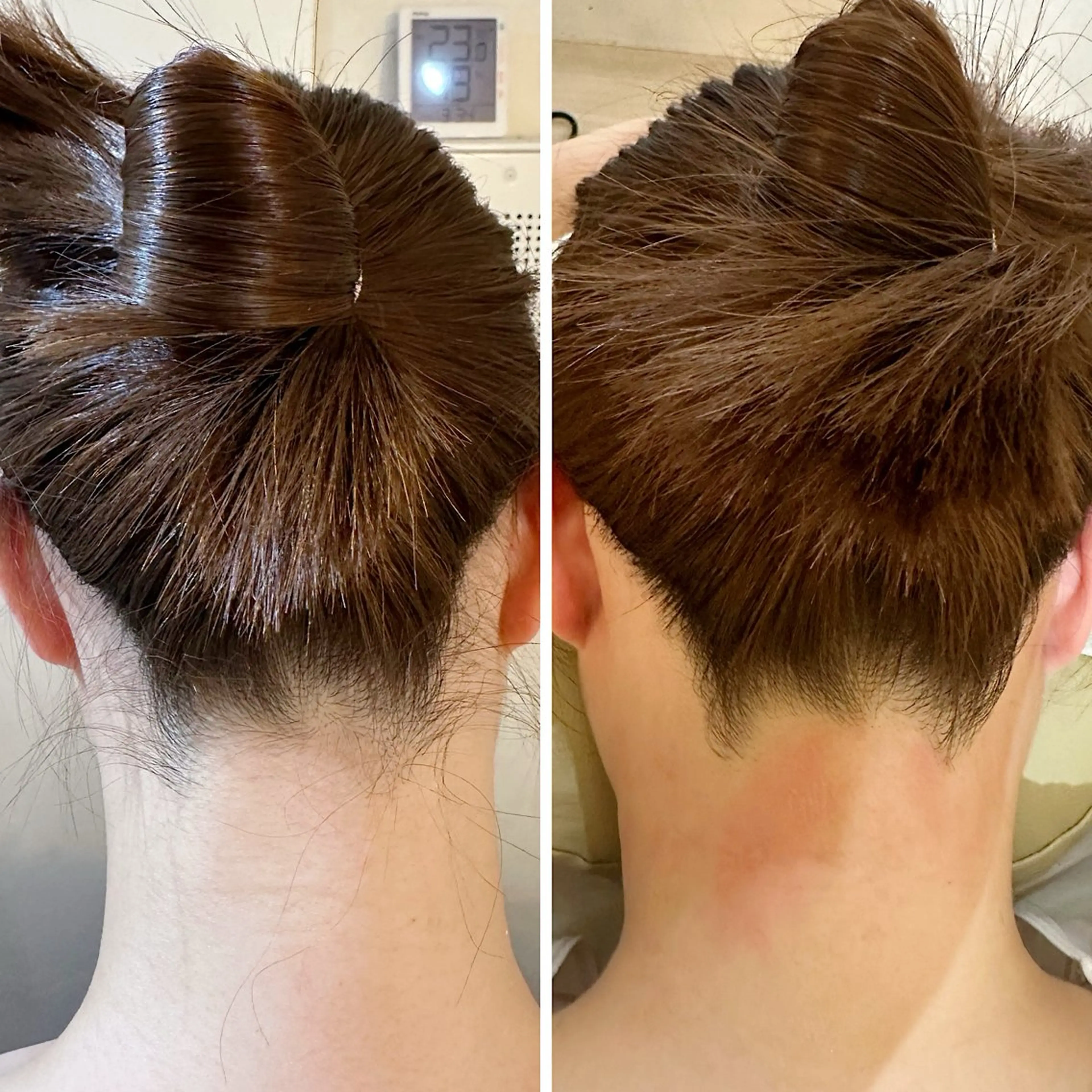 脱毛 うなじ脱毛/美肌脱毛 LABELのエステ・リラクイメージ