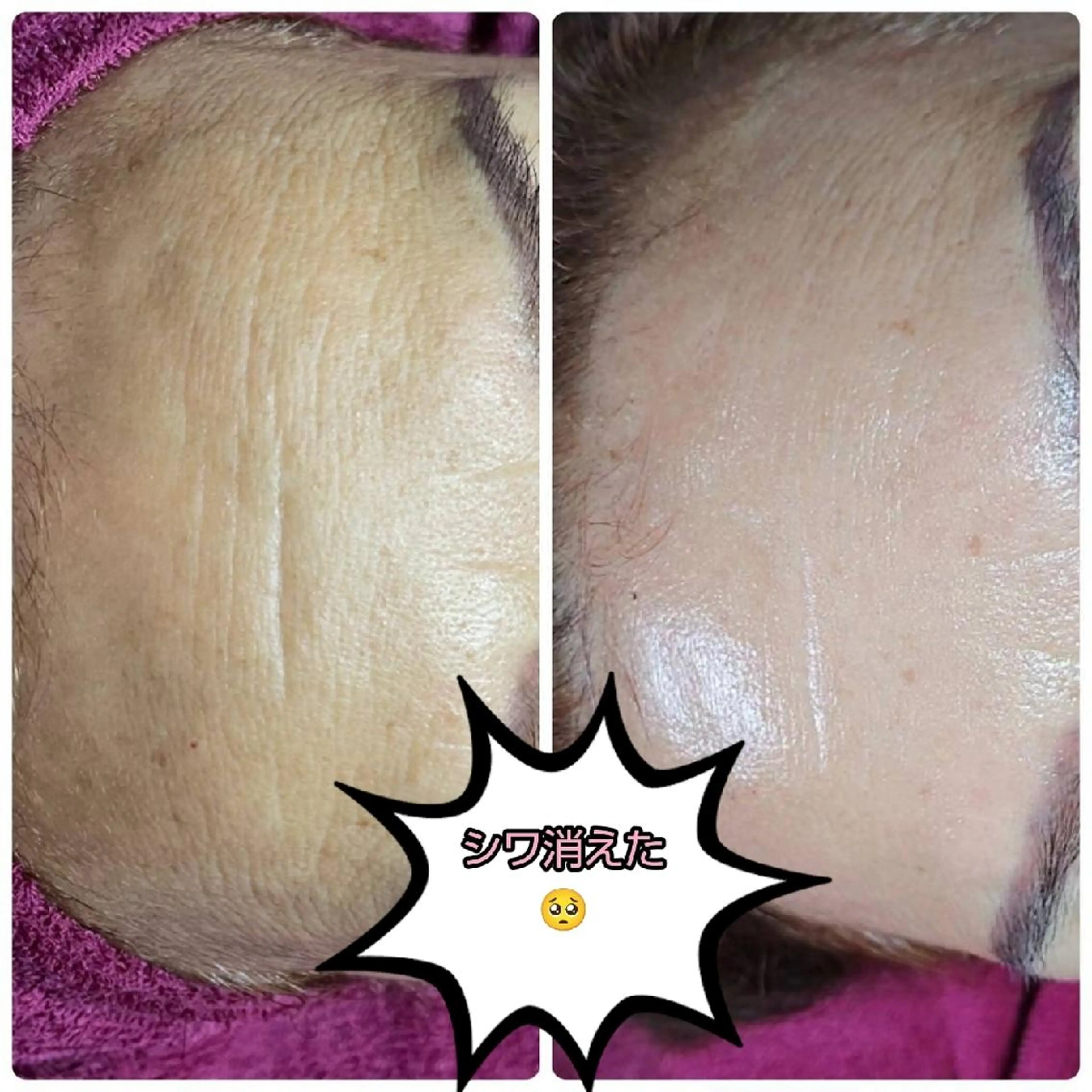 エステ viage所属・viage 脱毛&フェイシャル店のエステ・リラクイメージ