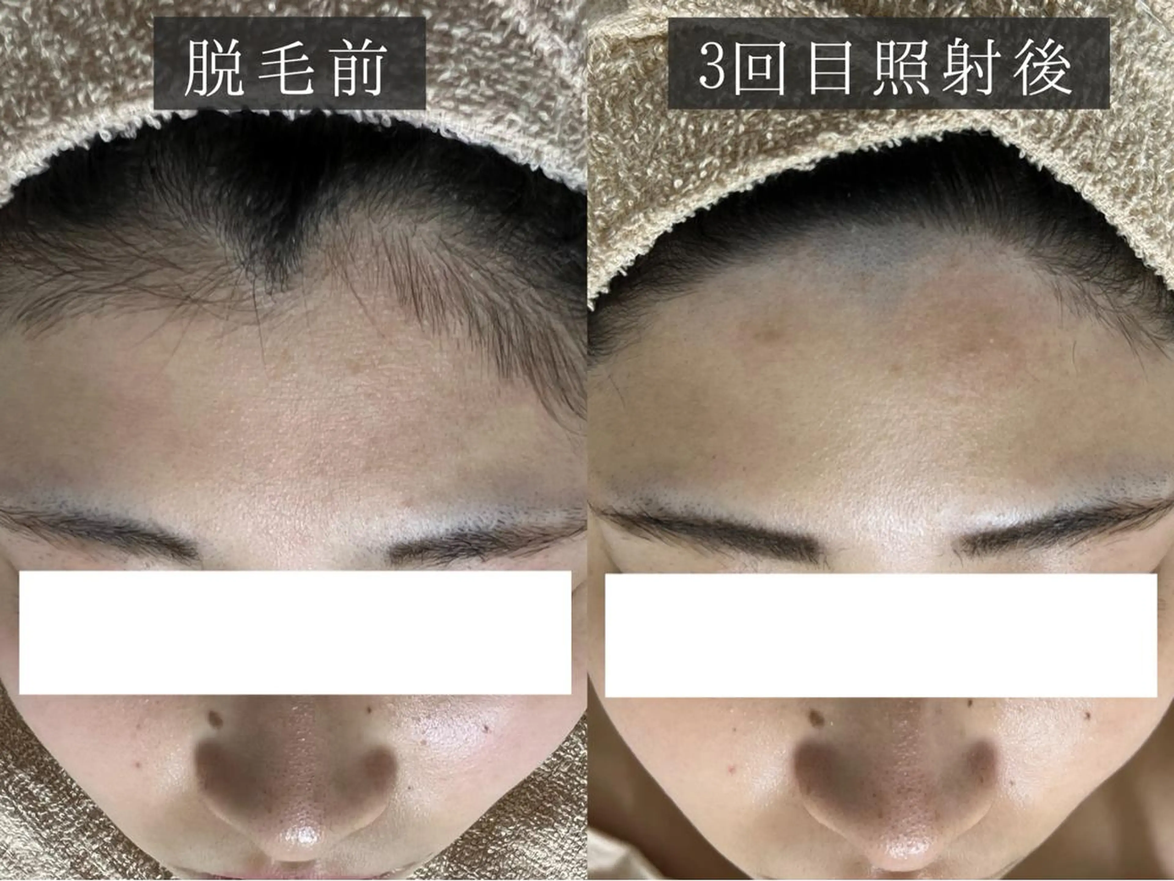 脱毛 脱毛専門サロン BELFINE恵比寿のエステ・リラクイメージ