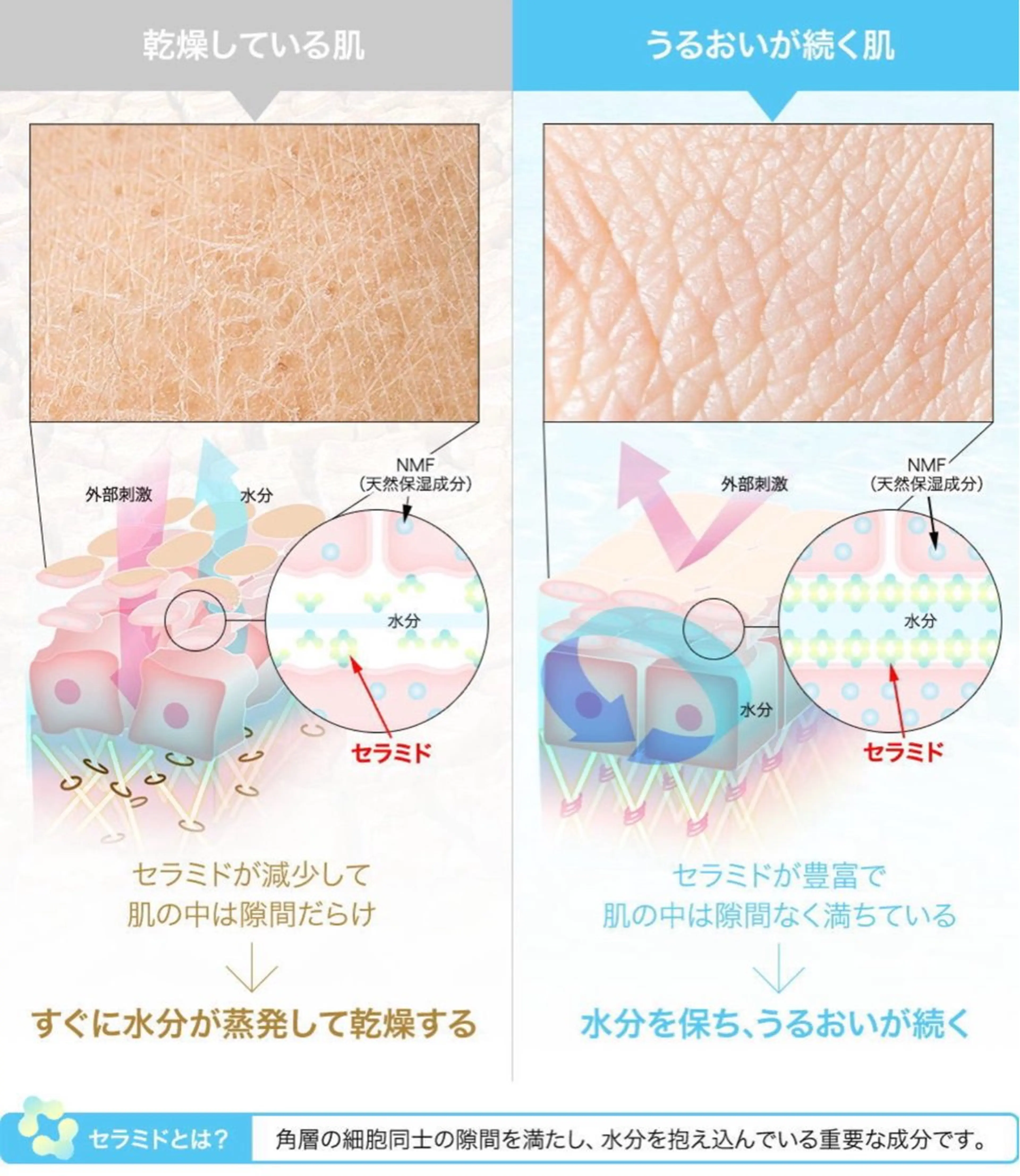 夏までに肌荒れ卒業 するサロン🌻のエステ・リラクイメージ