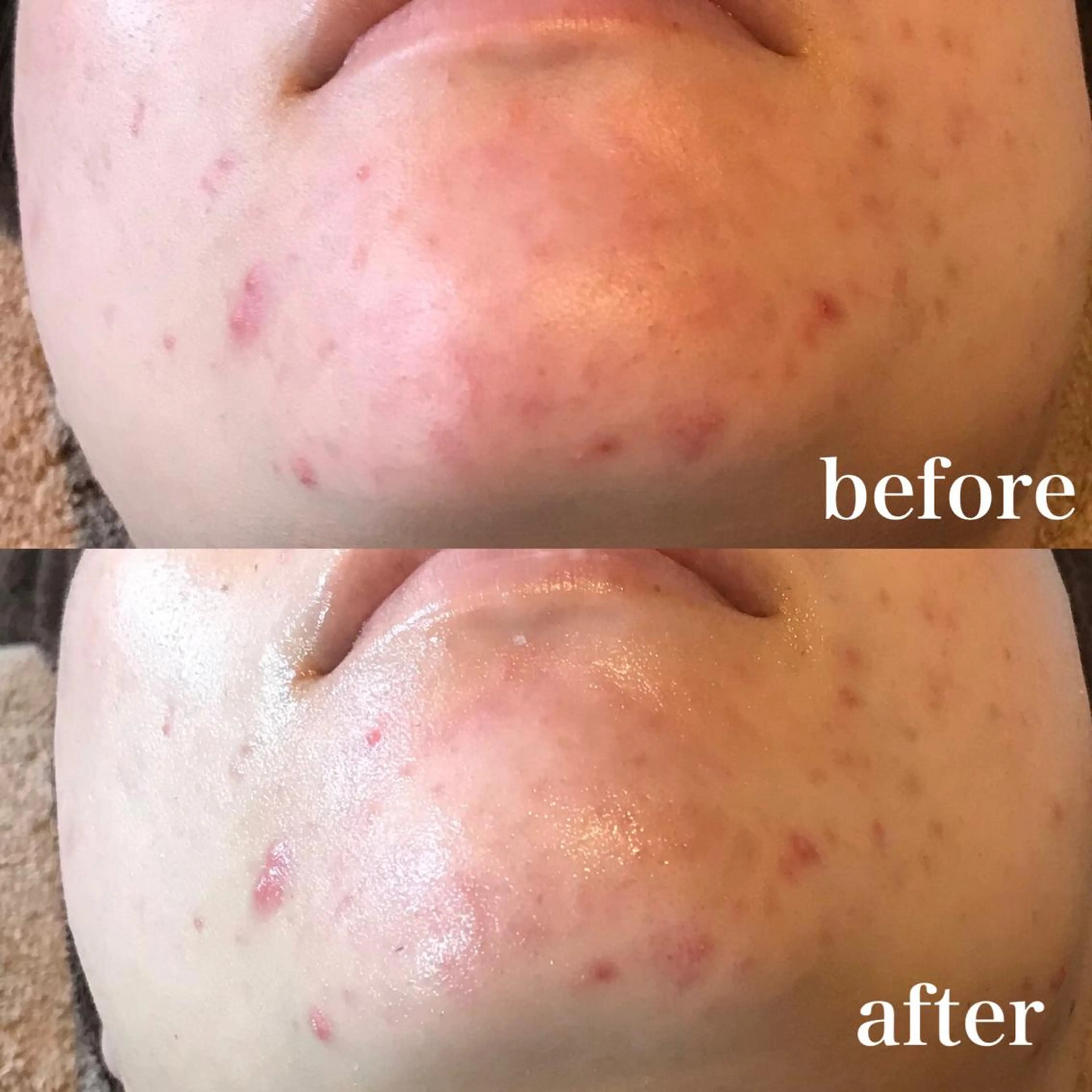 エステ 浜野 恵美のエステ・リラクイメージ