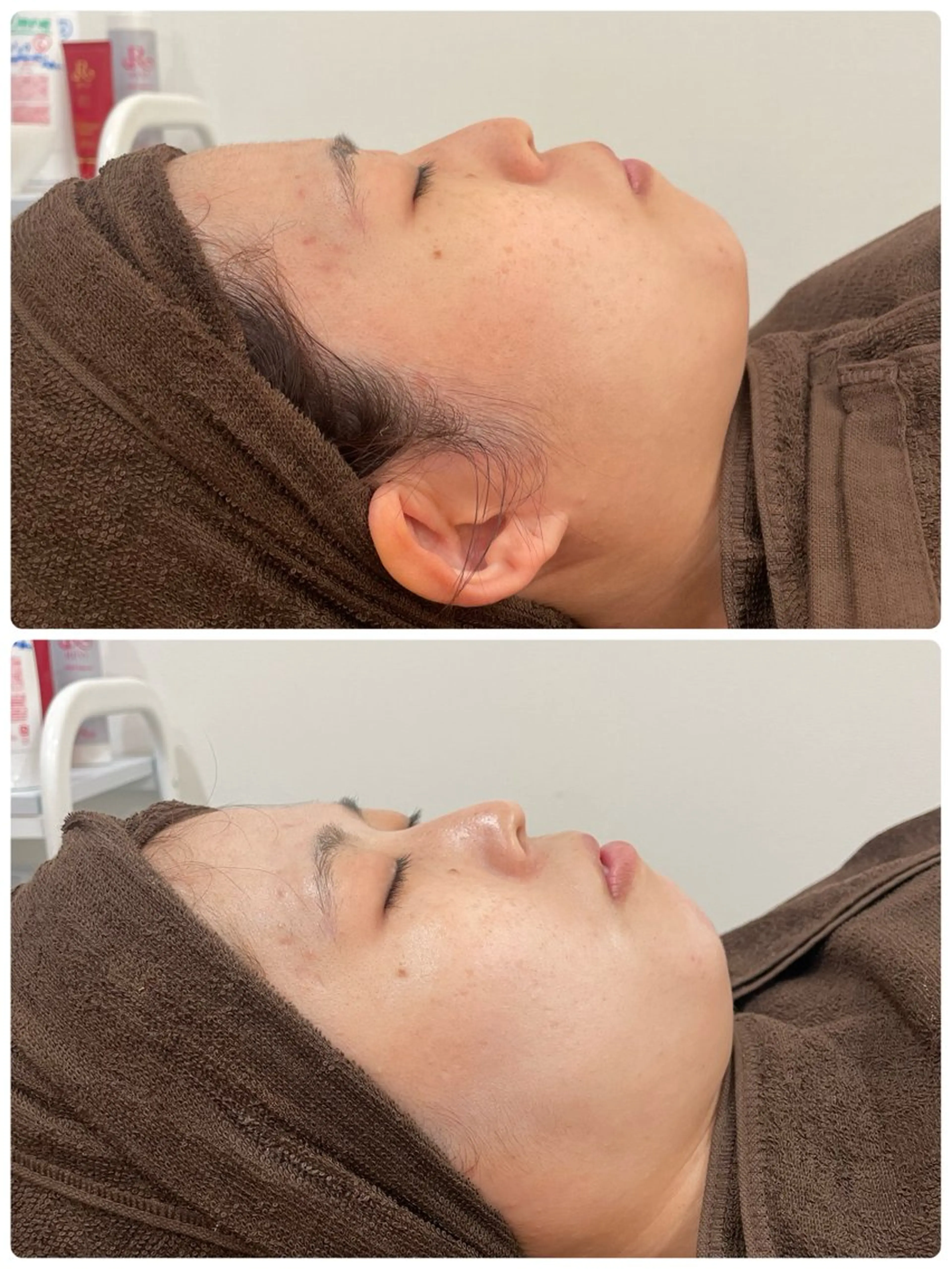 美白プルプル透明感UPコースの写真