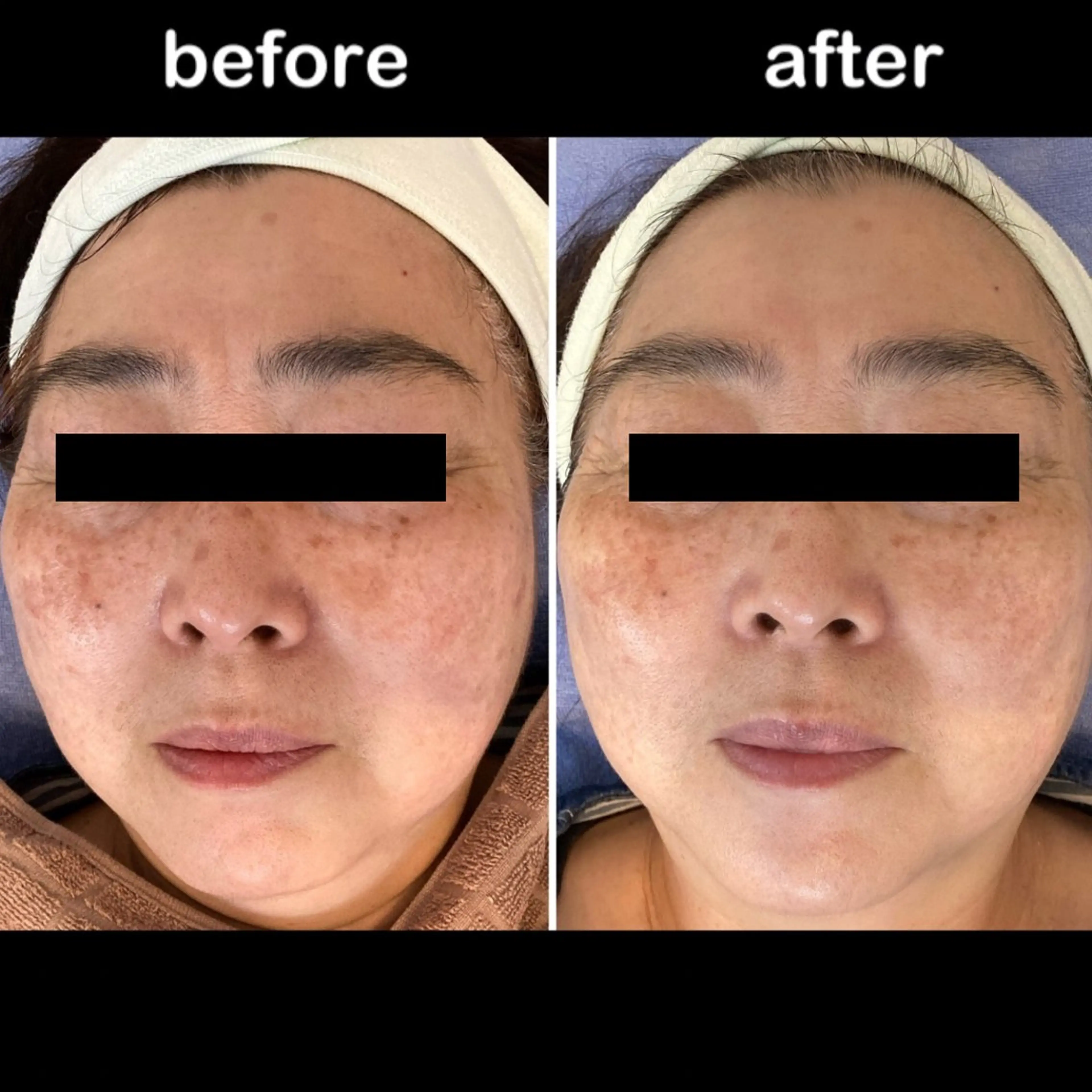 プレジール所属・ビューティサロン プレジールOTAKEのエステ・リラクイメージ