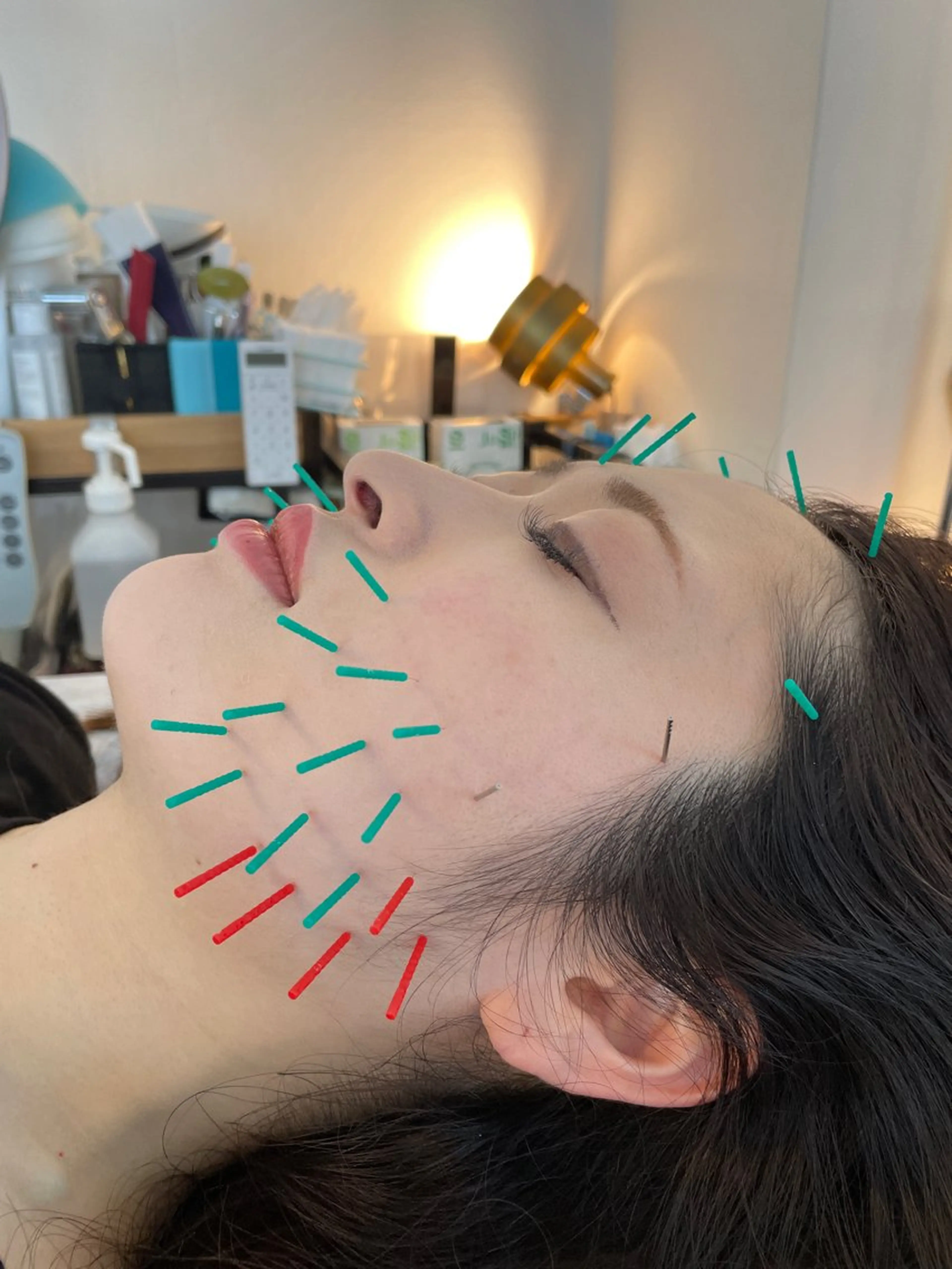 エステ リラク 小顔美容鍼専門サロン 渋谷YZのエステ・リラクイメージ