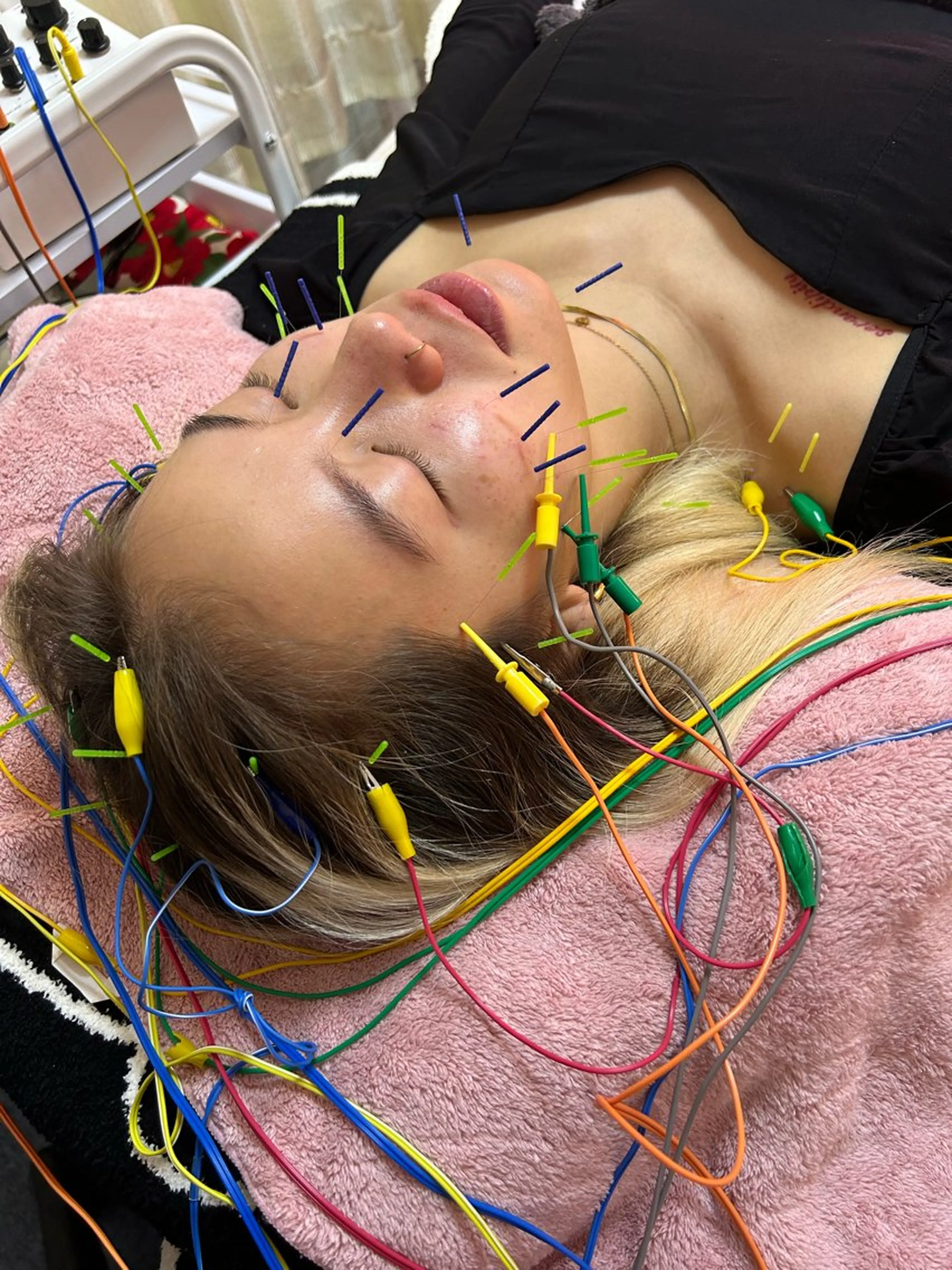 美容鍼灸サロン mahoroba院長のエステ・リラクイメージ