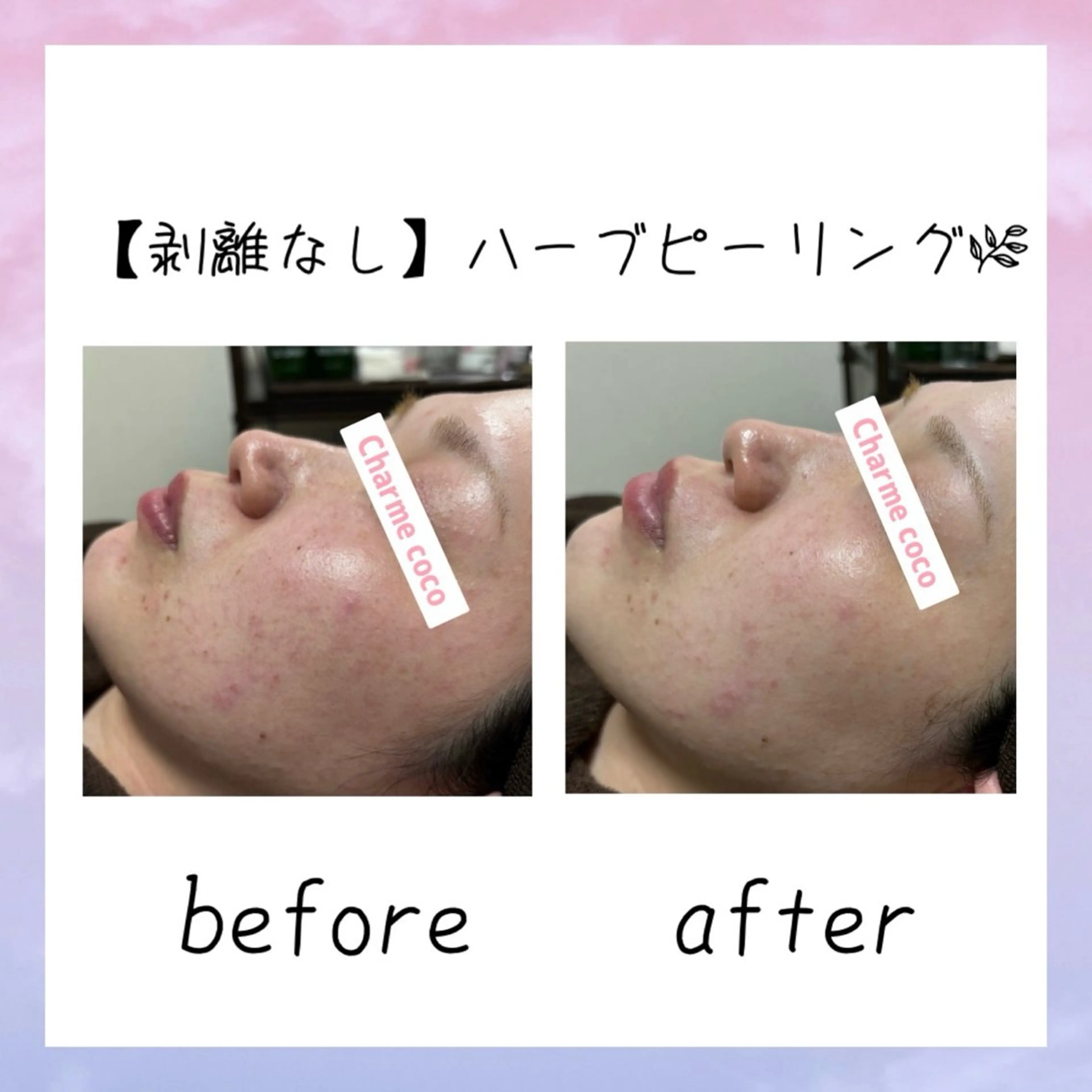 肌質改善Charme coco 増毛のエステ・リラクイメージ