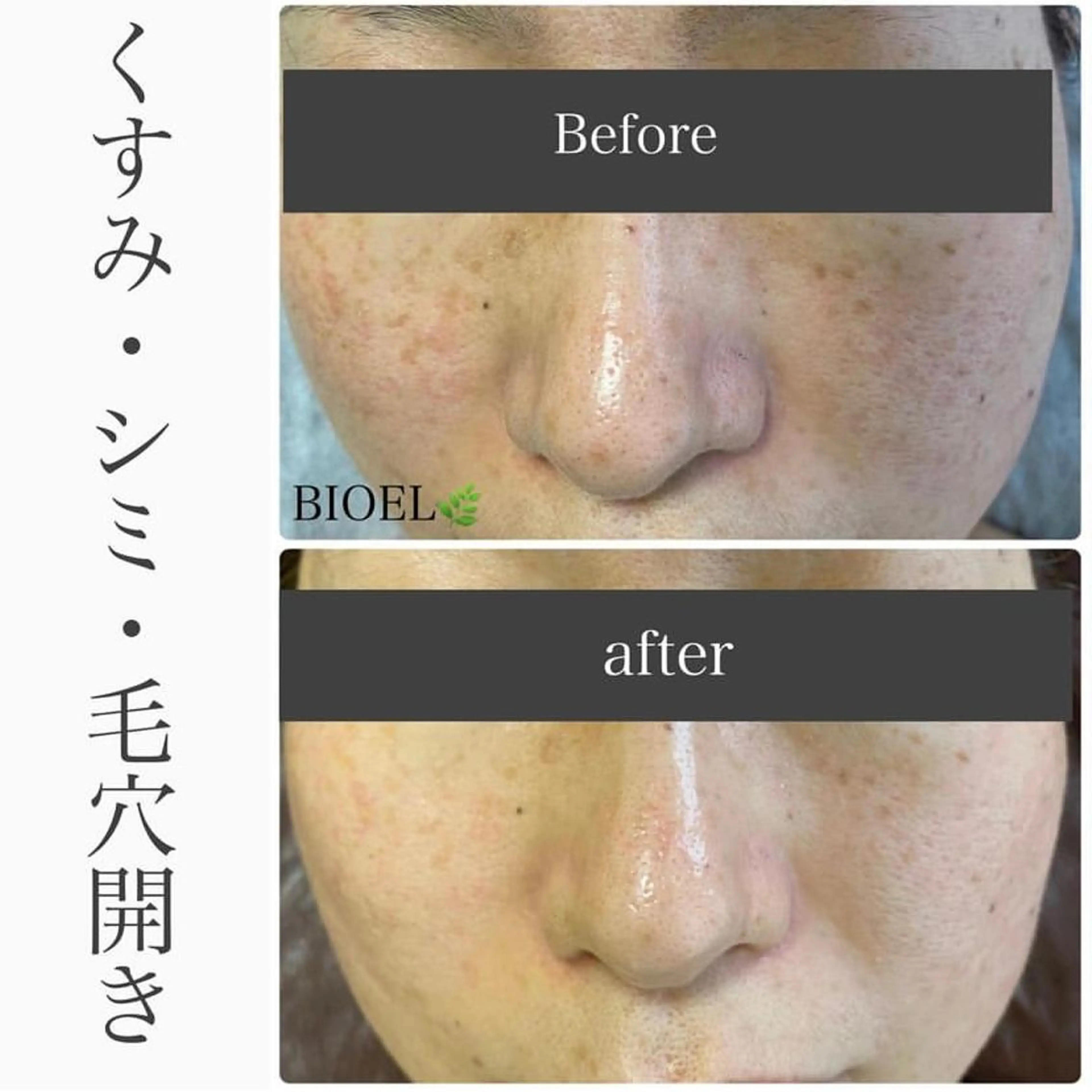 エステ ハーブピーリング専門 BIOPLUS+川崎のエステ・リラクイメージ