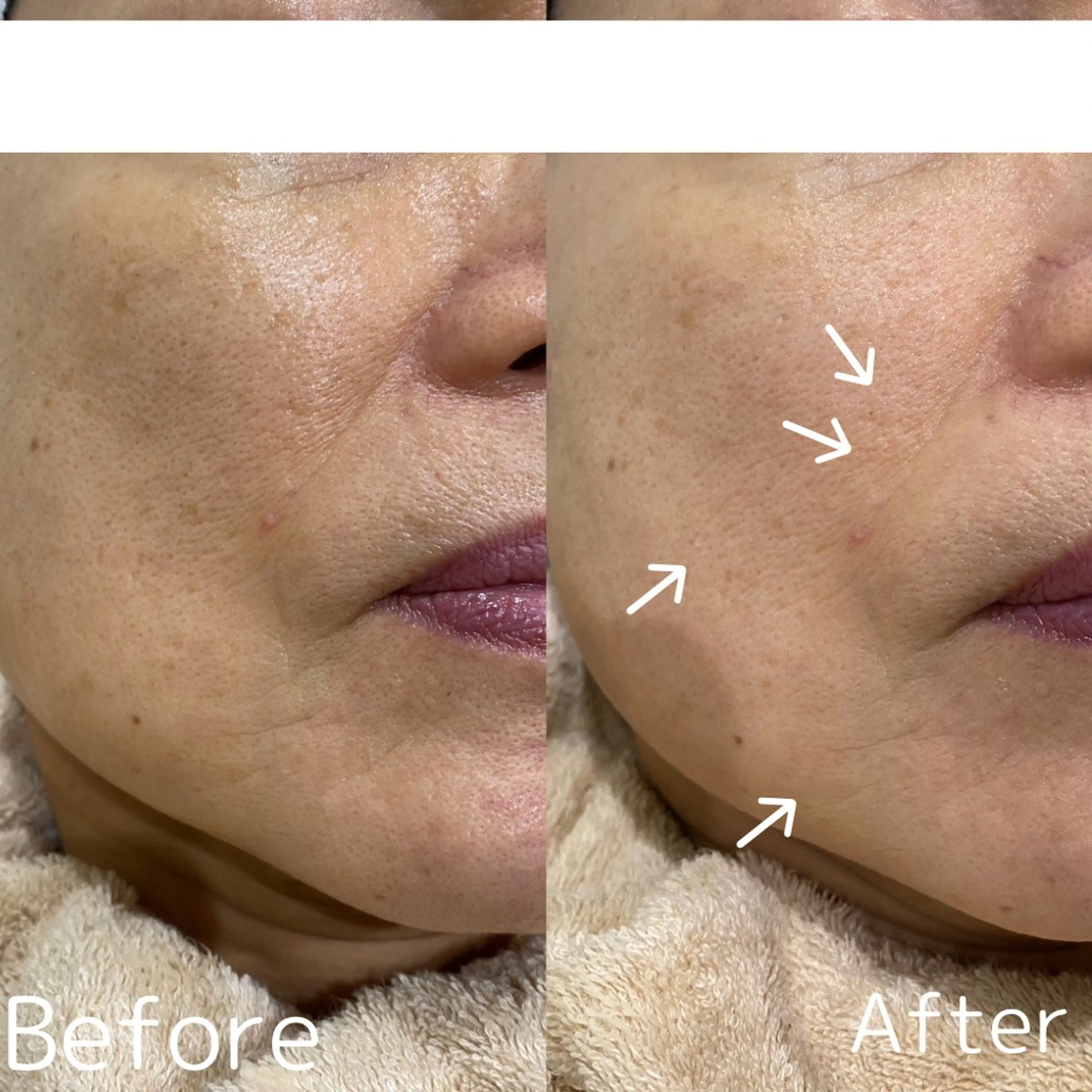 エステ Del'm豊橋所属・豊橋De'Im 安部のエステ・リラクイメージ