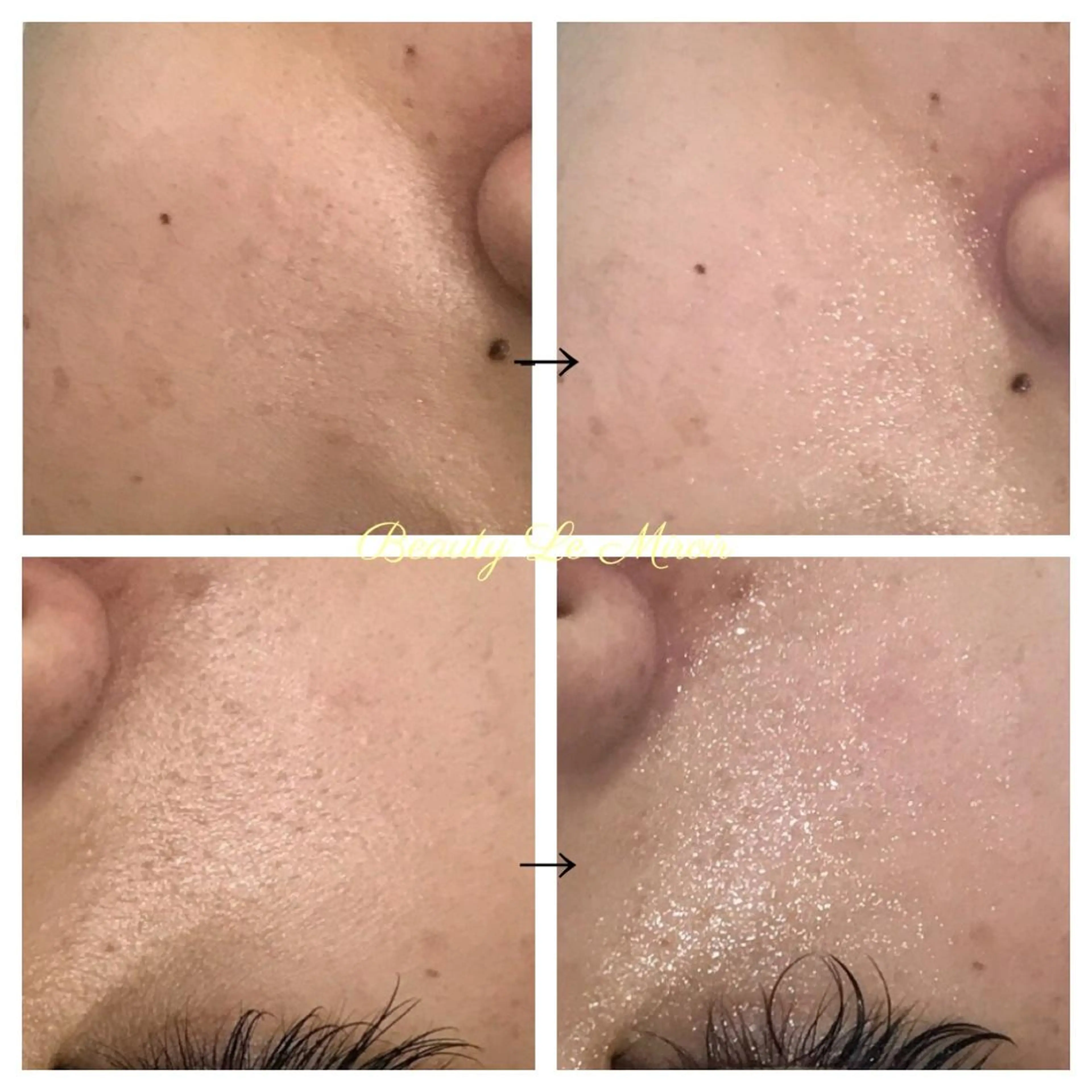 ビューティー ミロワールのエステ・リラクイメージ