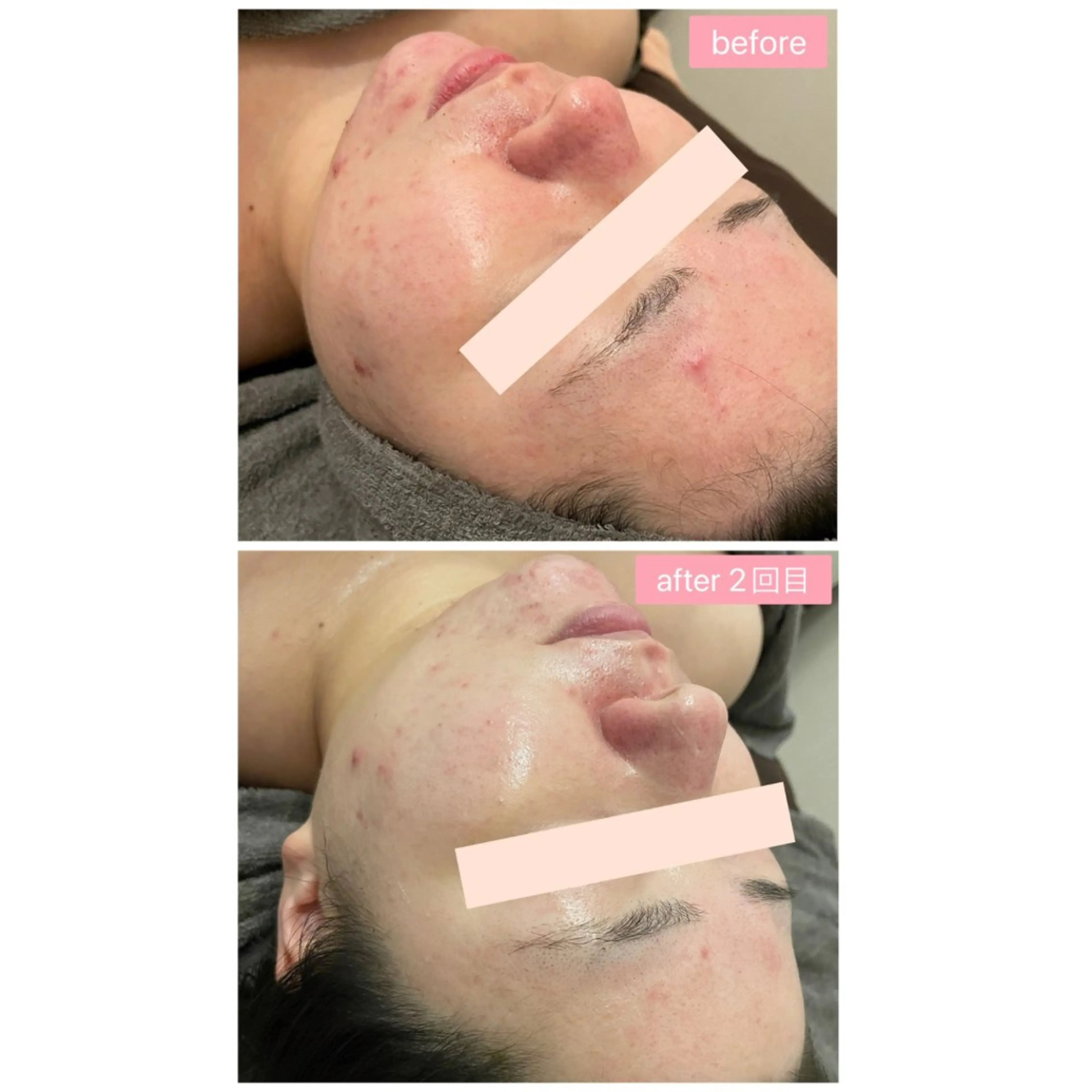 Monart -deux-のエステ・リラクイメージ