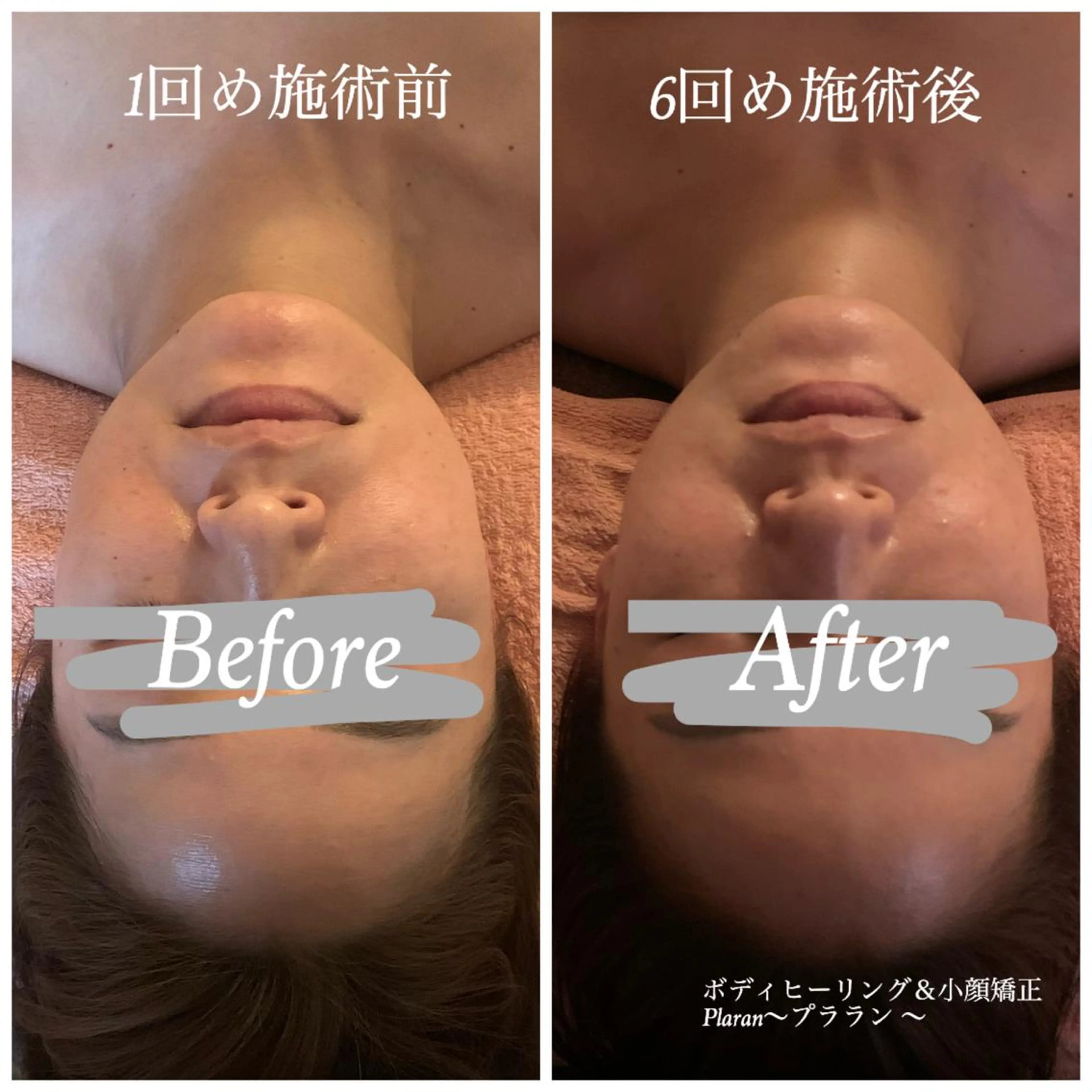 Plaran 〜プララン 〜のその他イメージ