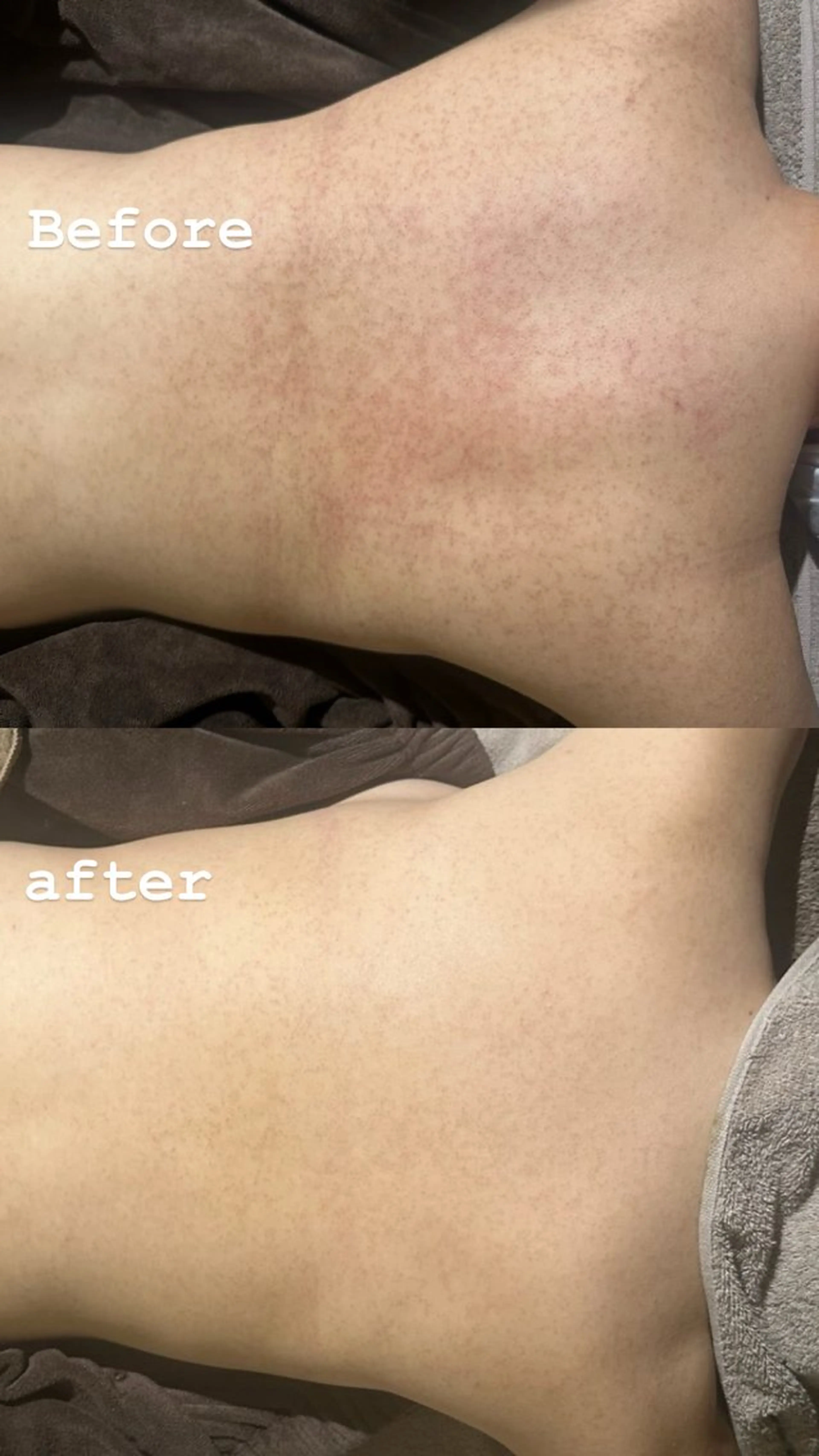 エミルカ 自由が丘店所属・ニキビ改善ハーブ🌿 ハナシマのその他イメージ