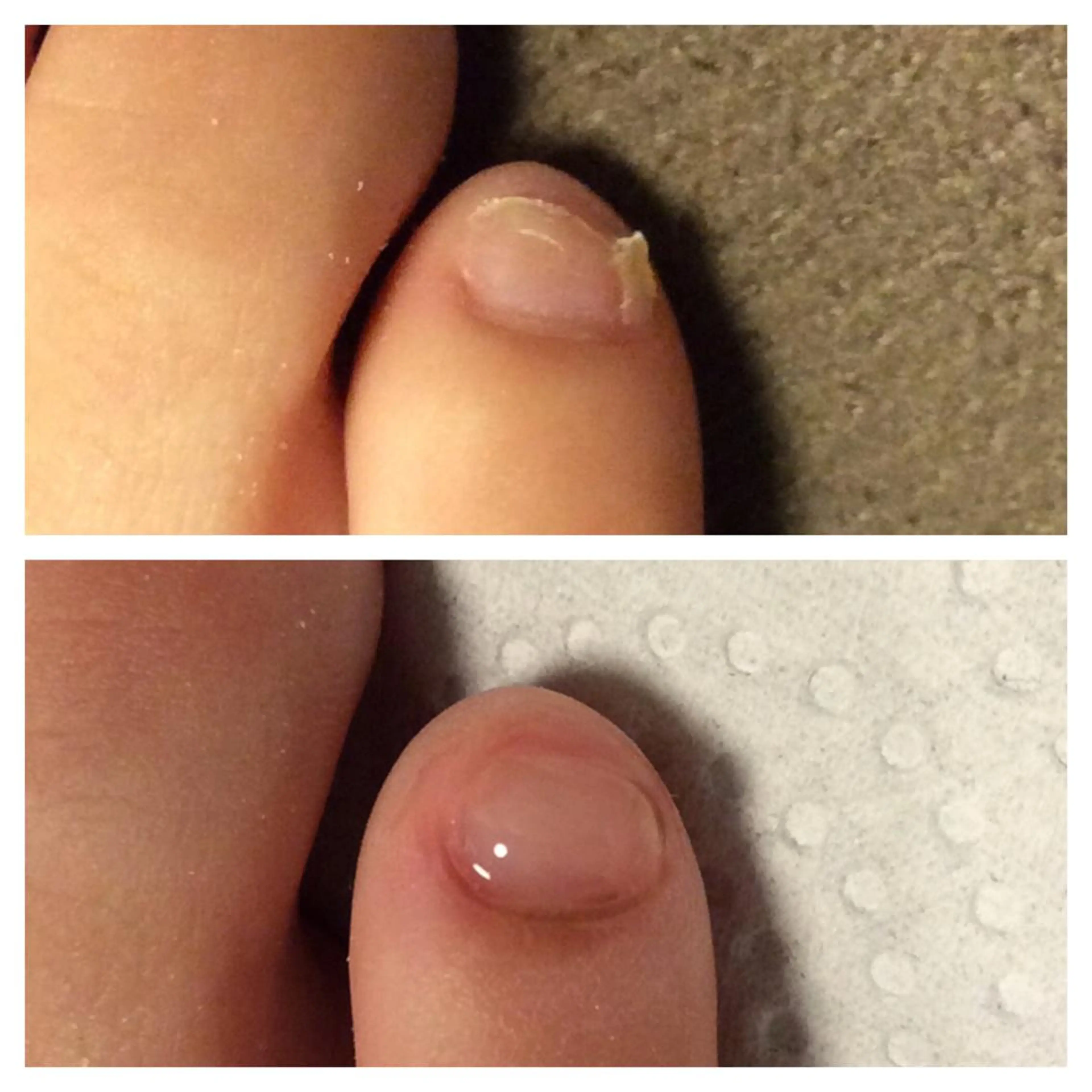 メンズ キッズ ネイル フットネイル 🌱 ま し お 🌱のその他イメージ