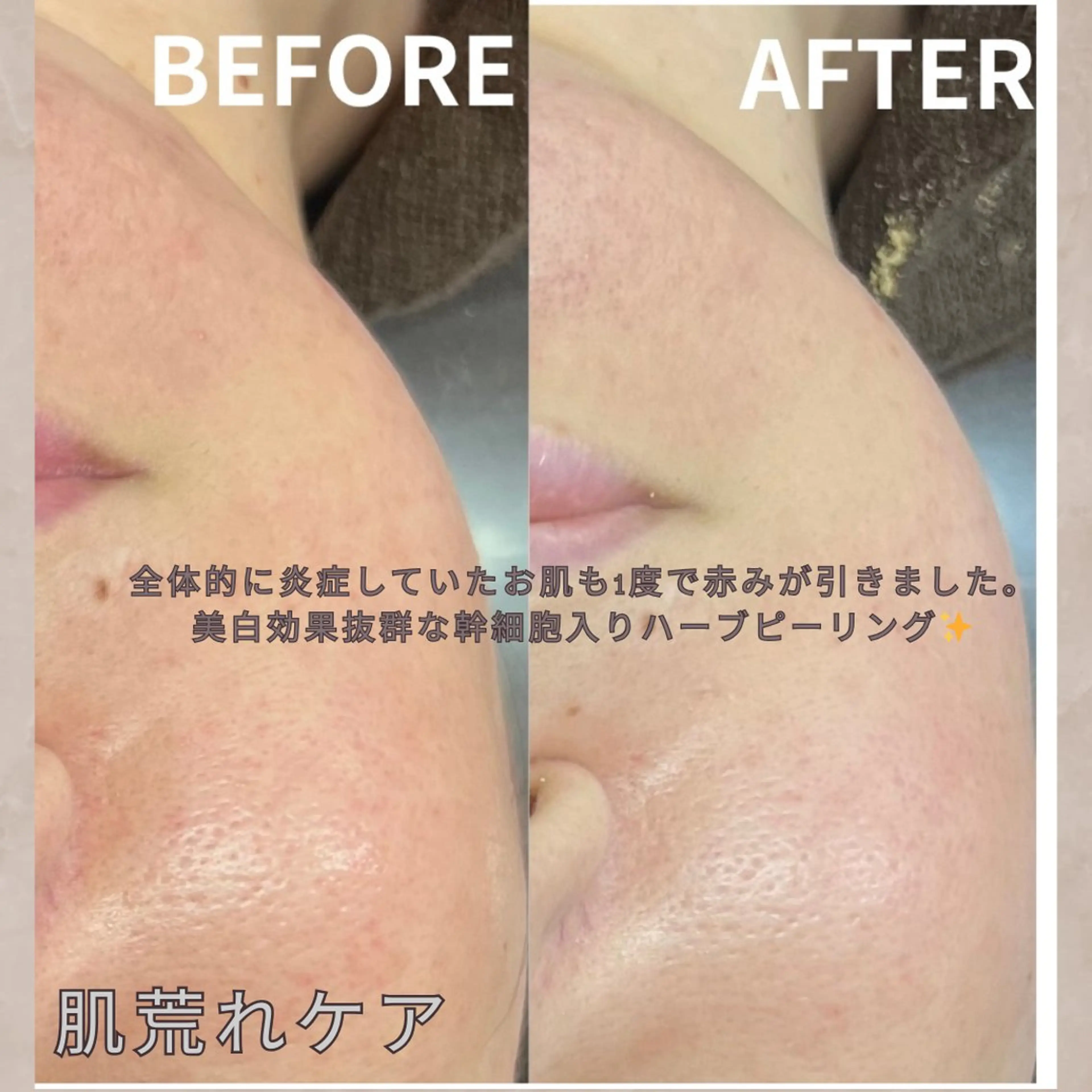 エステ 大橋 唯のエステ・リラクイメージ