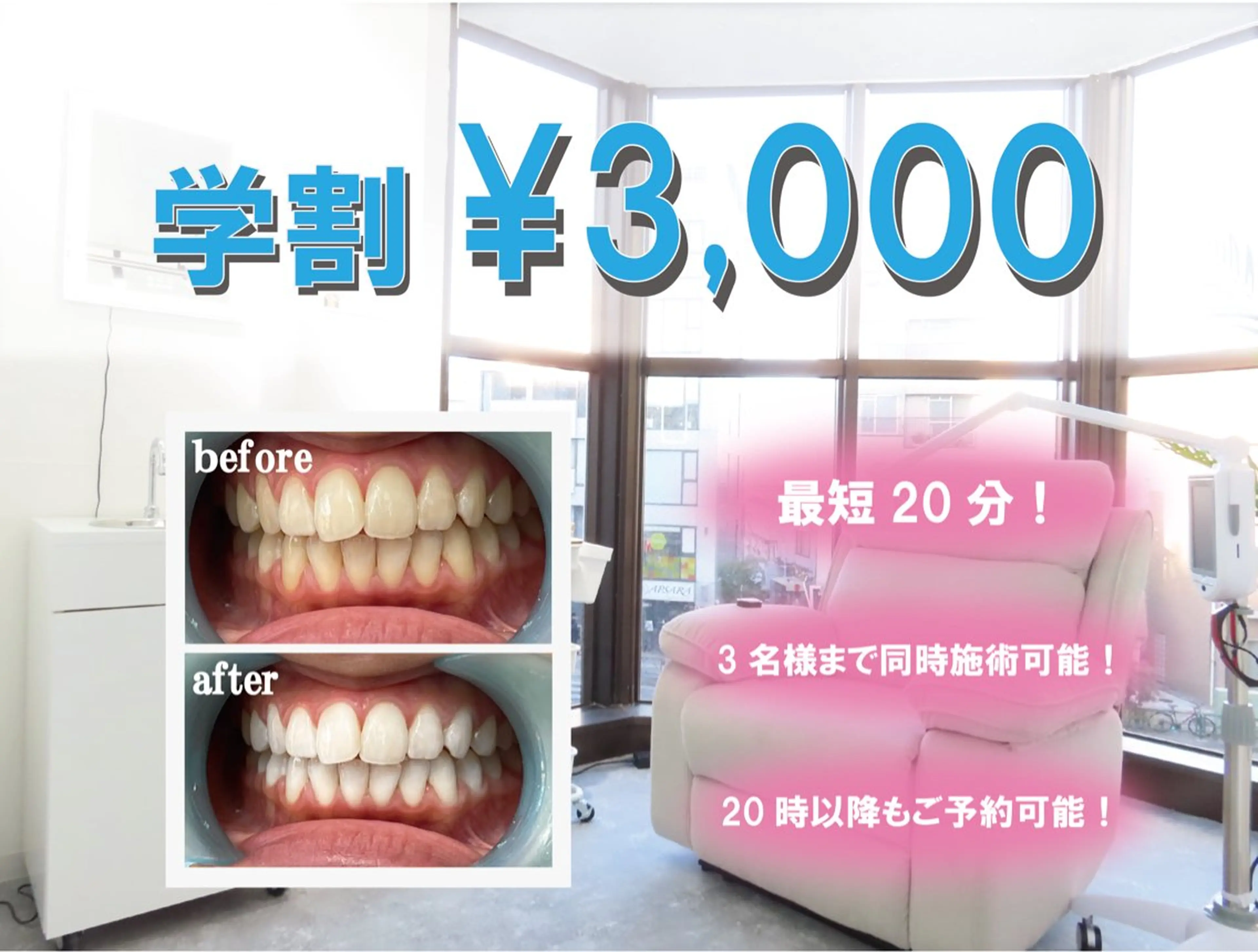 【ホワイトニング】学割コース ¥3,000の写真