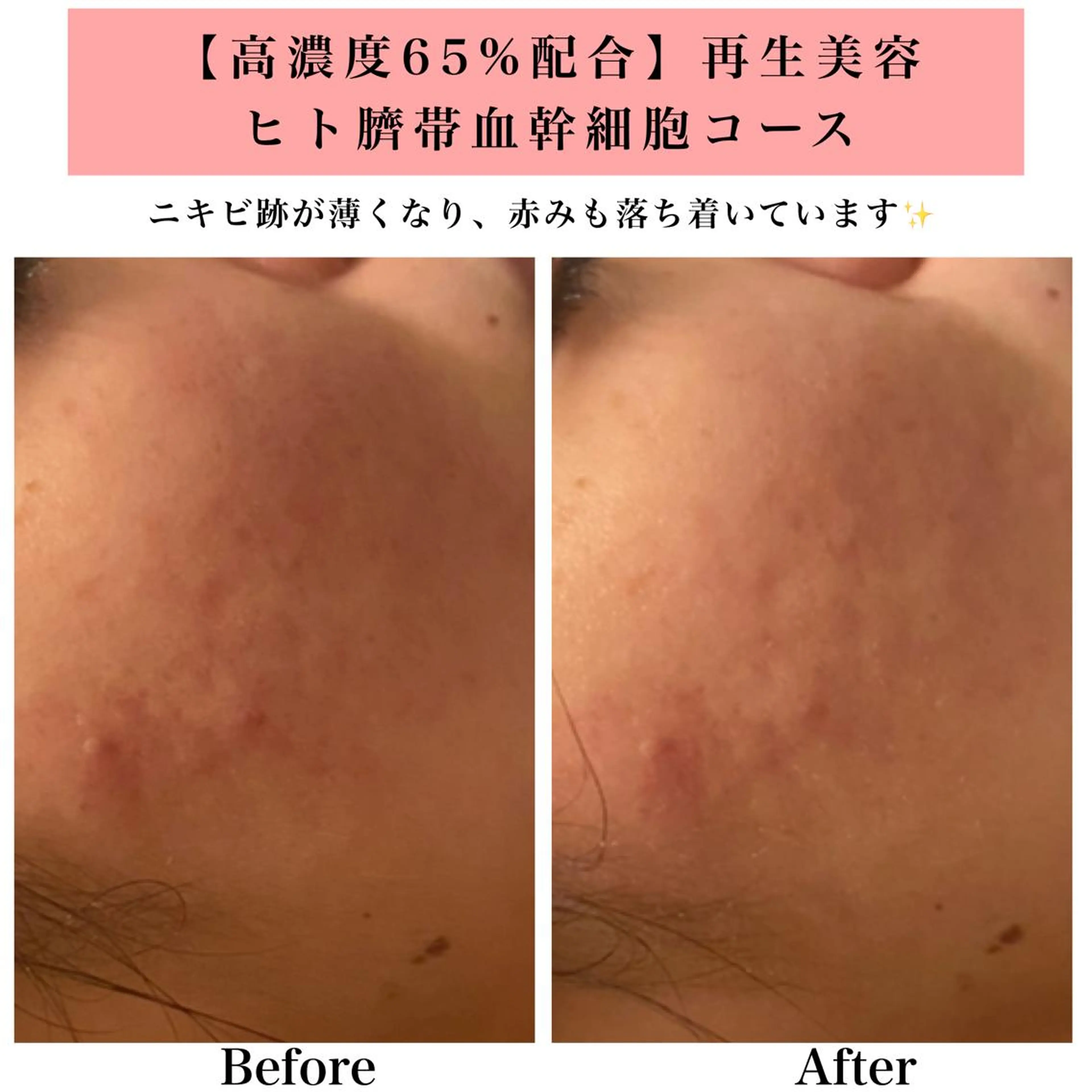 エステ リラク Bellesthe （ベルエステ）のエステ・リラクイメージ