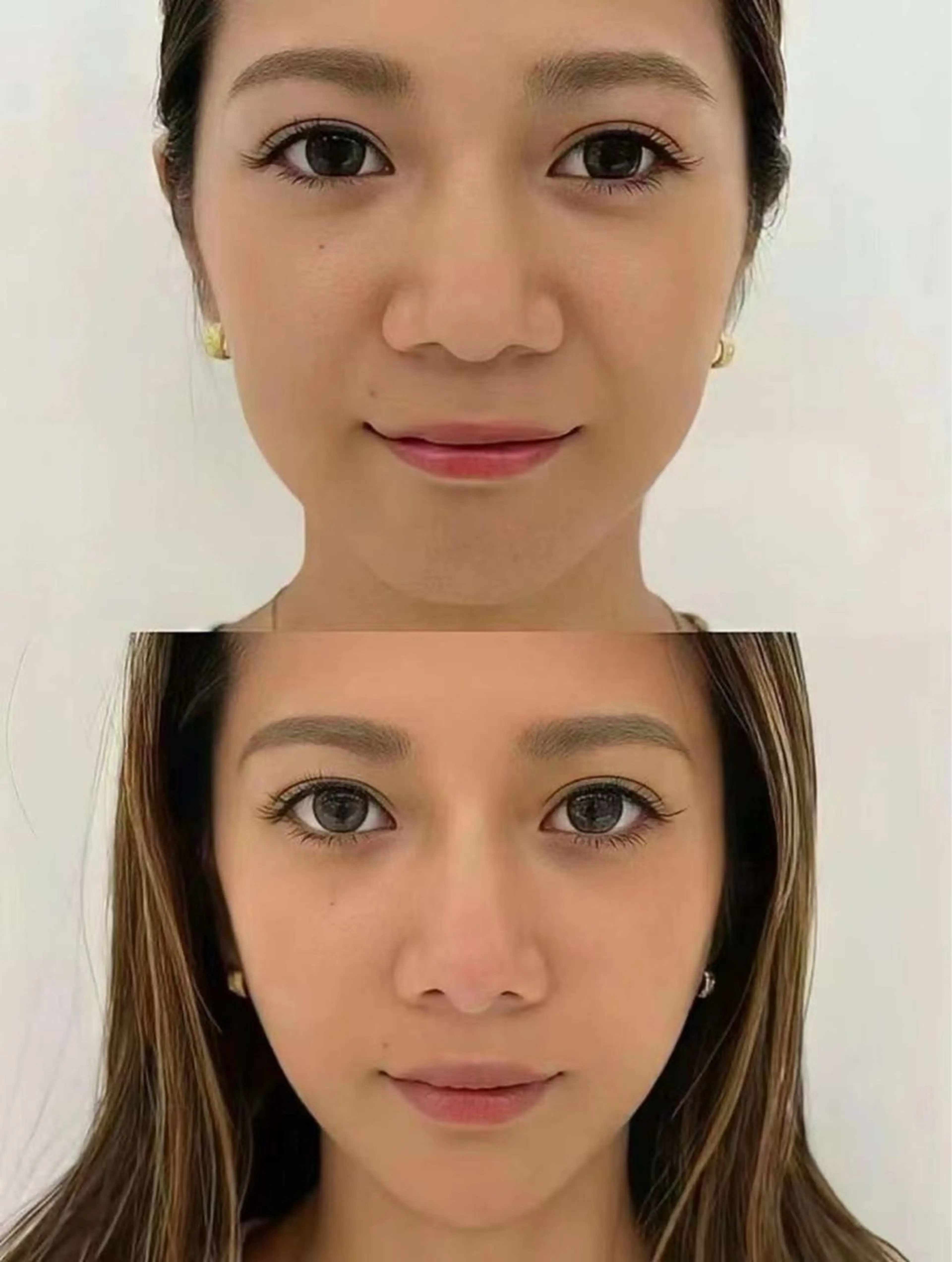 ネイル ブライダルネイル ホワイト エステ aliaハイフ&水光ジェットサロン所属・aliaハーブ水光店 エステティシャン募集のエステ・リラクイメージ