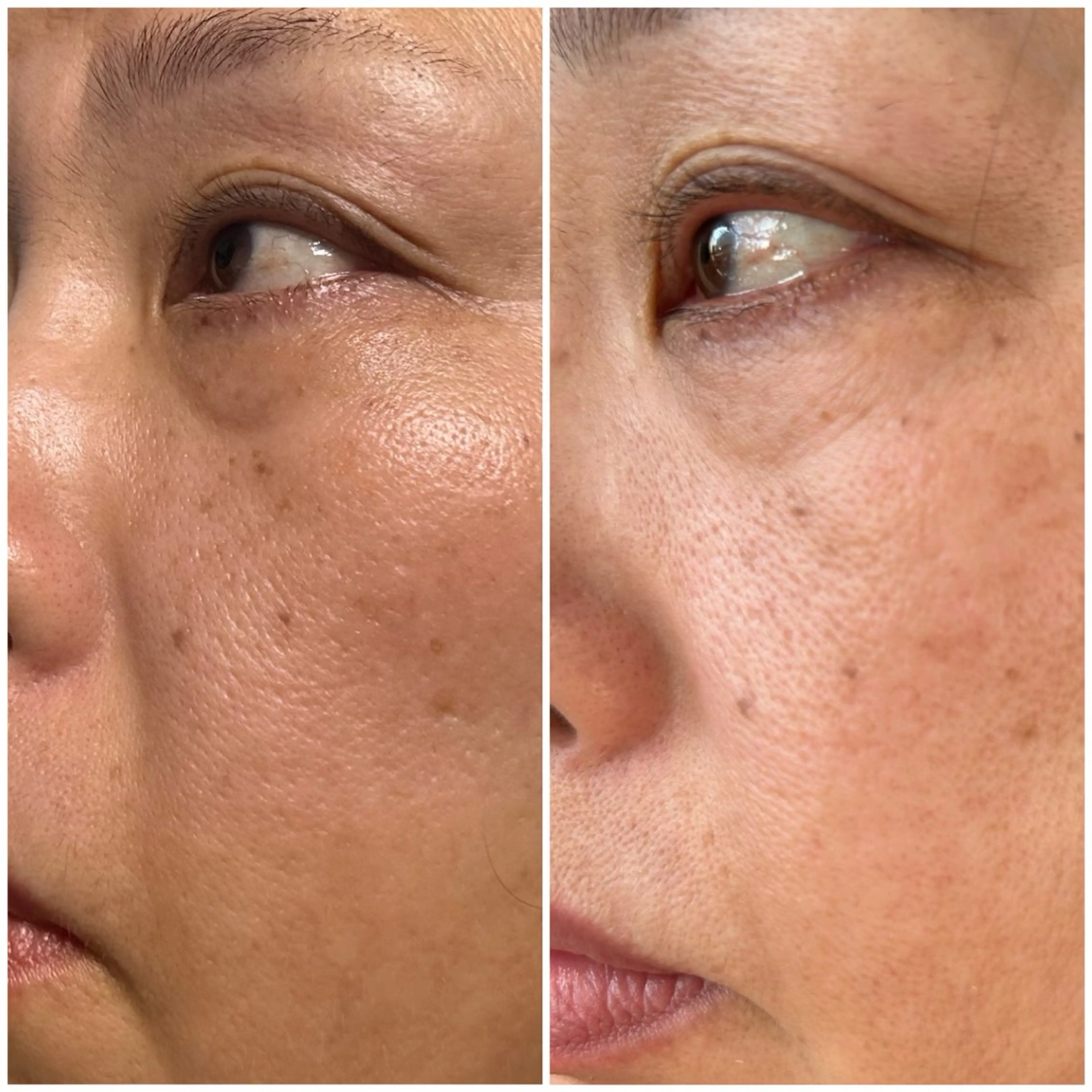 エステサロンMee. 大畑のエステ・リラクイメージ