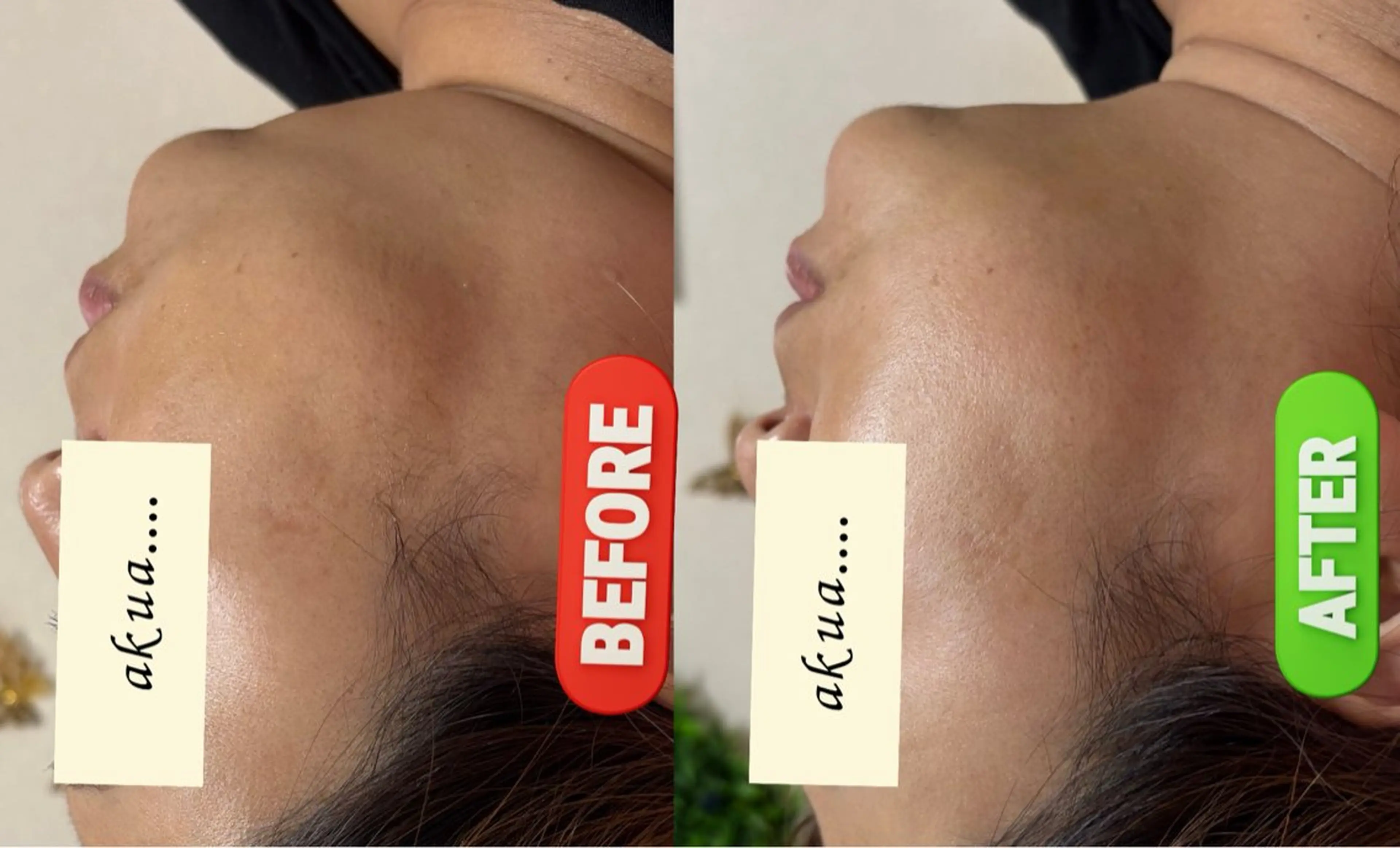 その他 akua... 【肌質管理専門】のその他イメージ