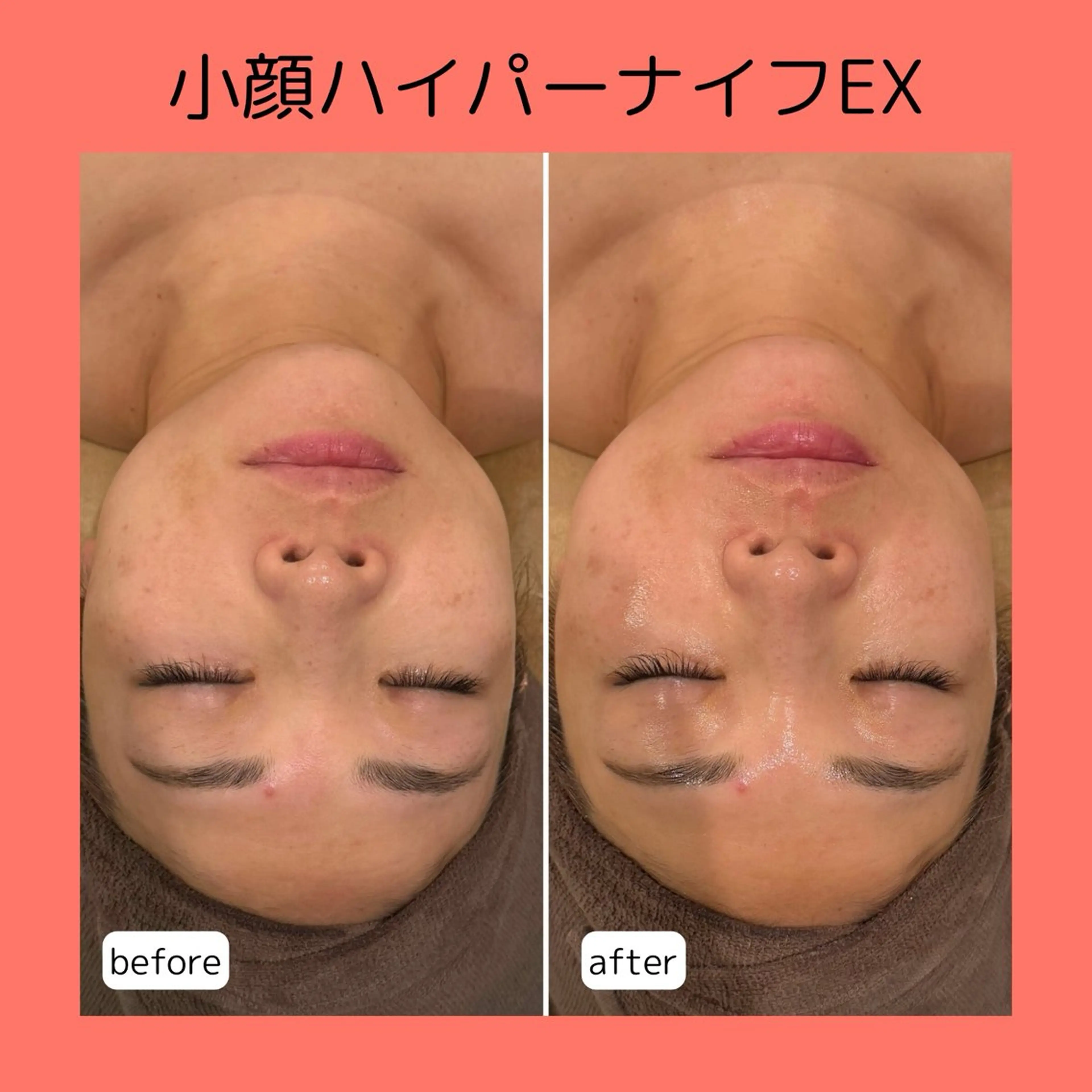 赤澤/本気痩せ・脱毛 ・ノーファンデ肌のその他イメージ