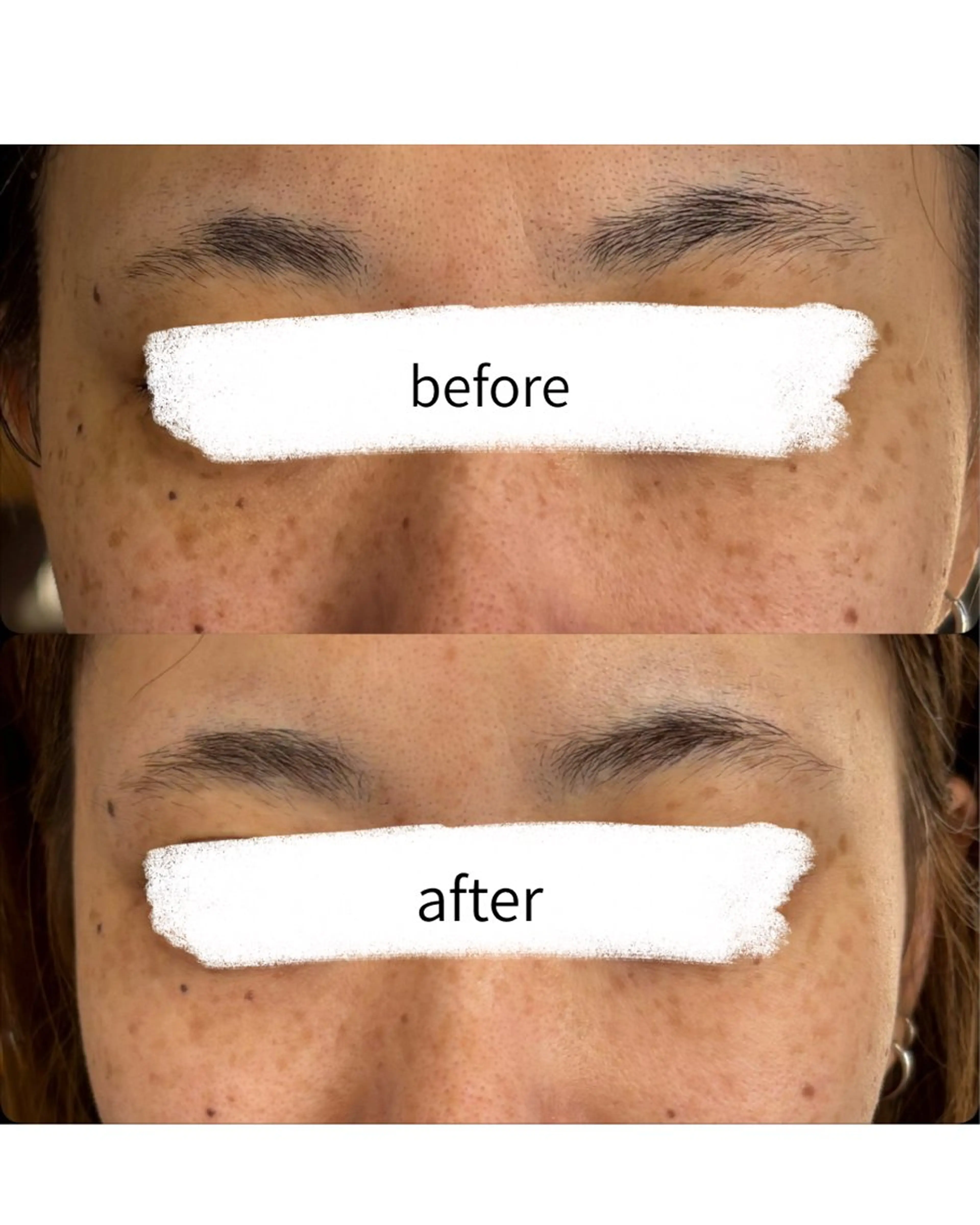 エステ 結果が出るスキンケア 肌質改善/まつパのエステ・リラクイメージ