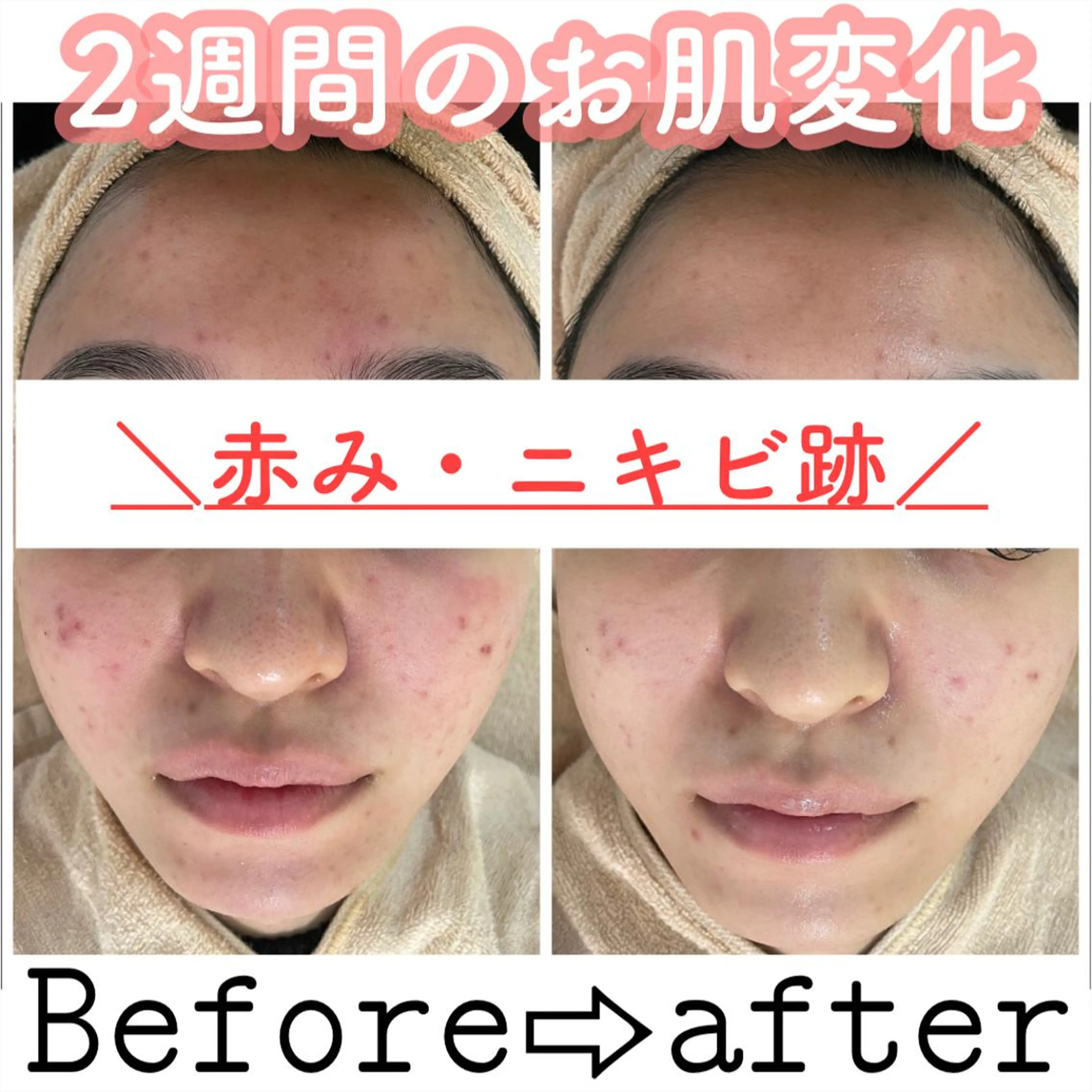 セミロング カラー パーマ ヘアアレンジ メンズ キッズ ネイル マツエク・マツパ エステ ニキビ&跡改善サロン オーナー光木のエステ・リラクイメージ