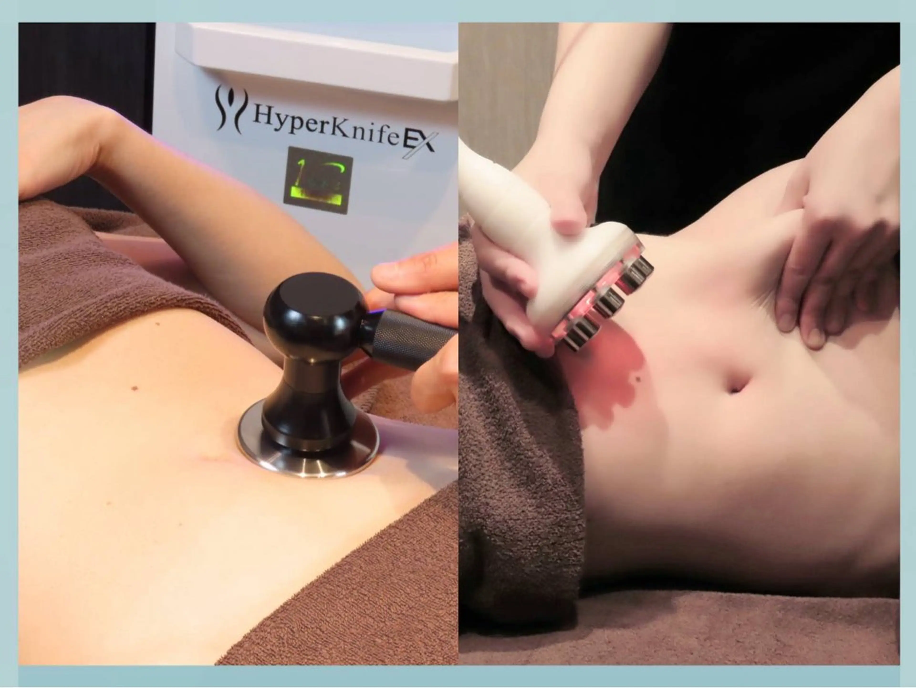 エステ リラク 痩身・小顔・美肌専門 Chou chouのエステ・リラクイメージ