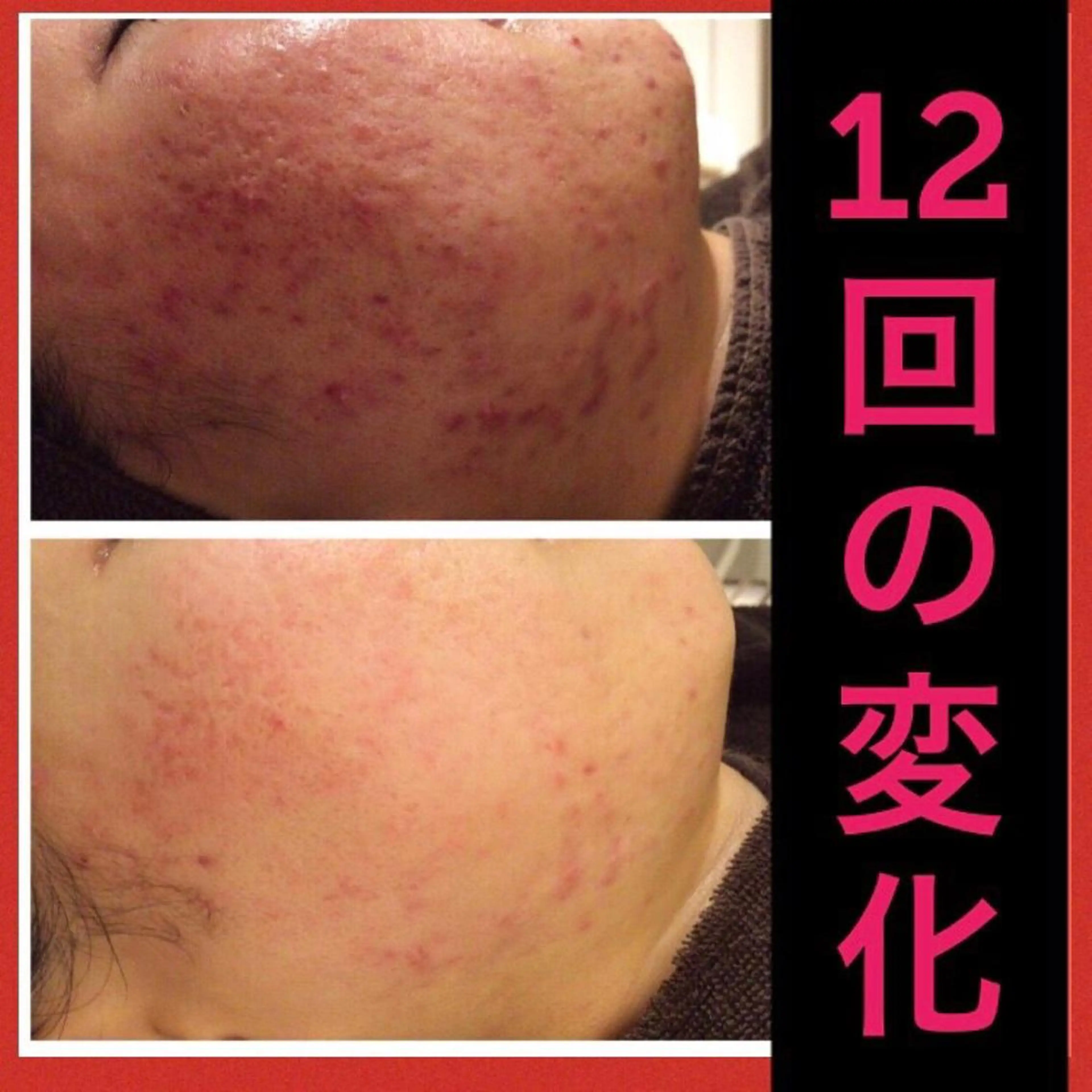 ショート カラー パーマ ヘアアレンジ メンズ キッズ ネイル マツエク・マツパ エステ リラク ニキビ・肌質改善専門 ♡人生が変わるサロンのエステ・リラクイメージ