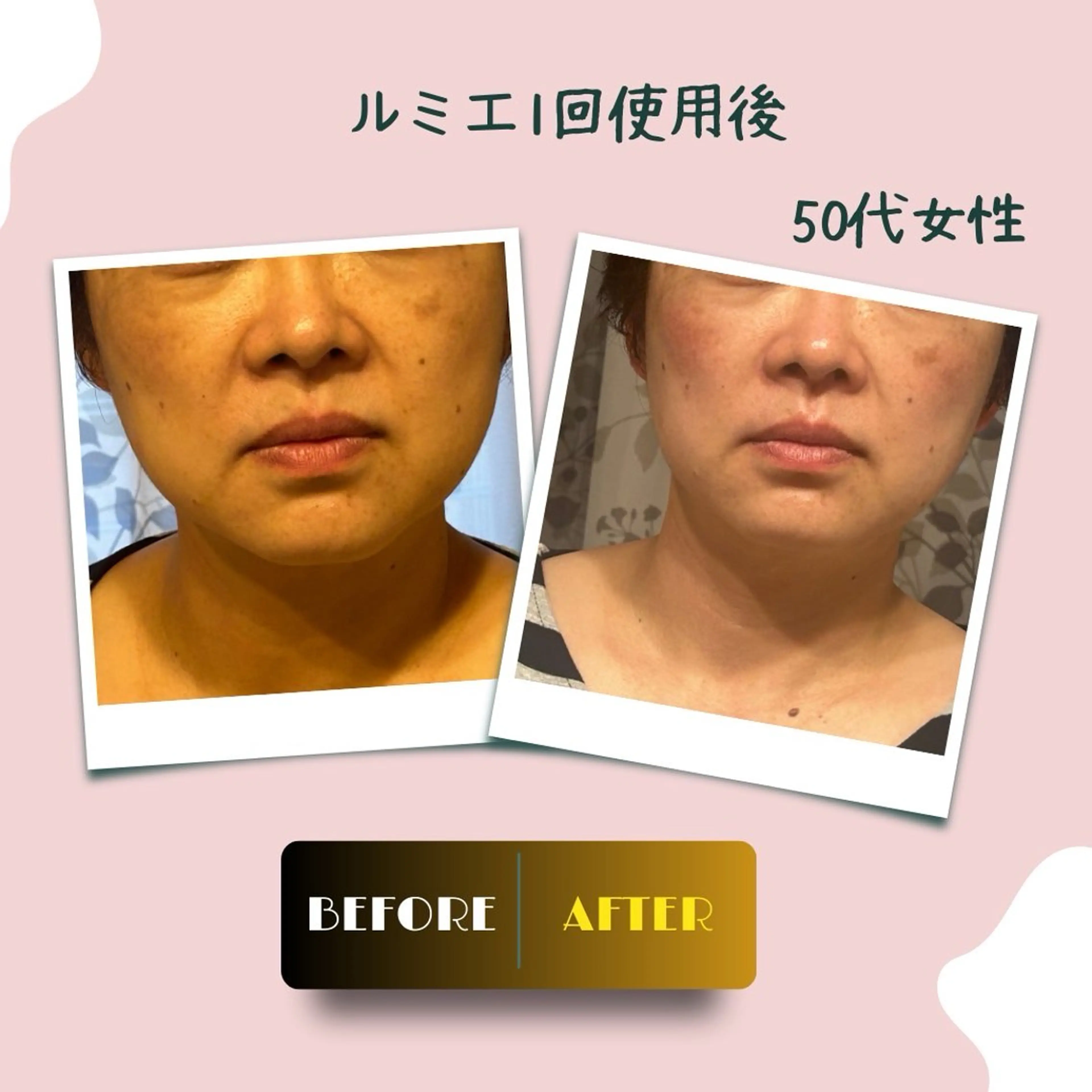 エステ 原田 夏美のその他イメージ