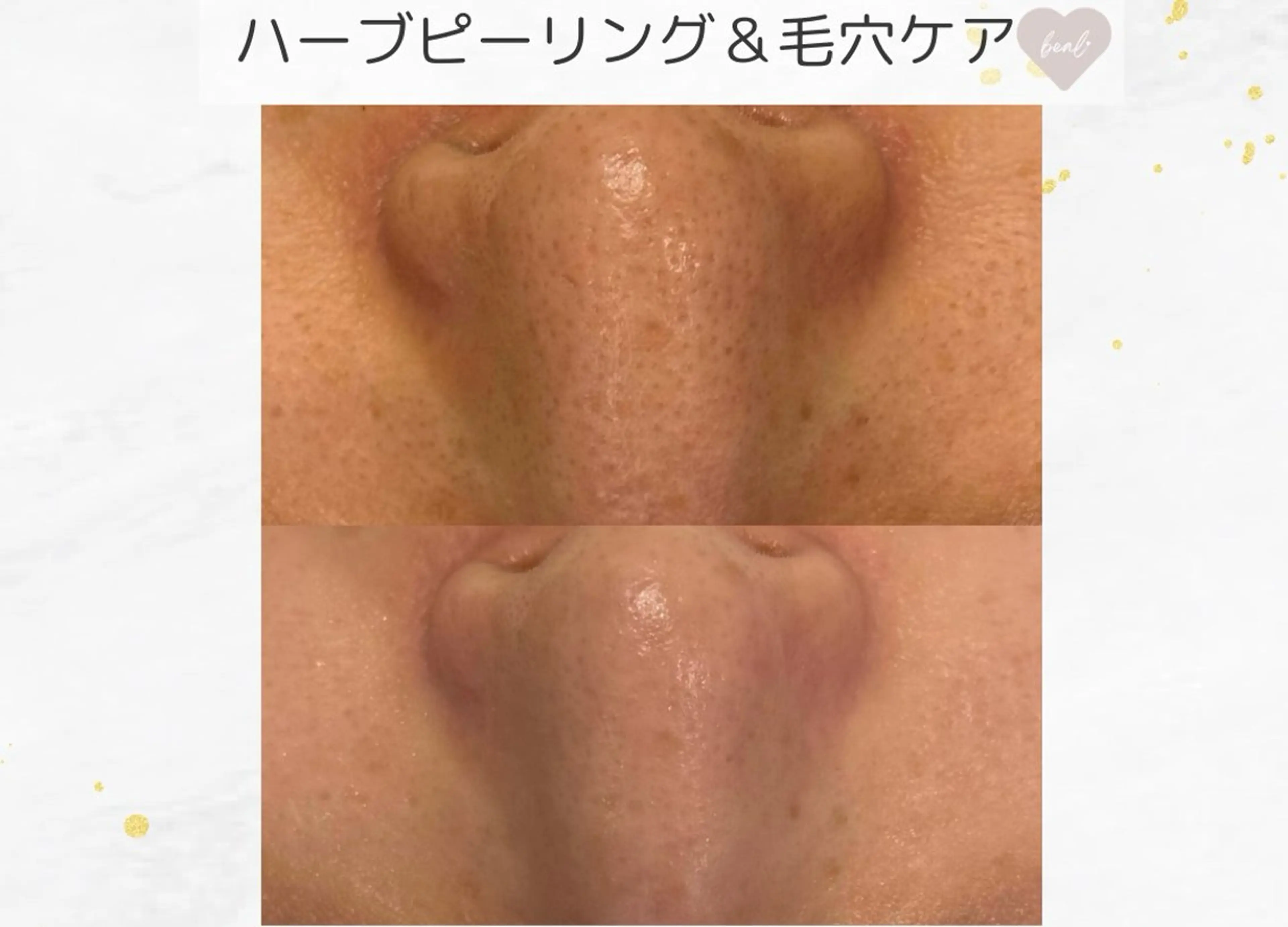 べアール所属・小顔/毛穴/ニキビ salon bealのその他イメージ