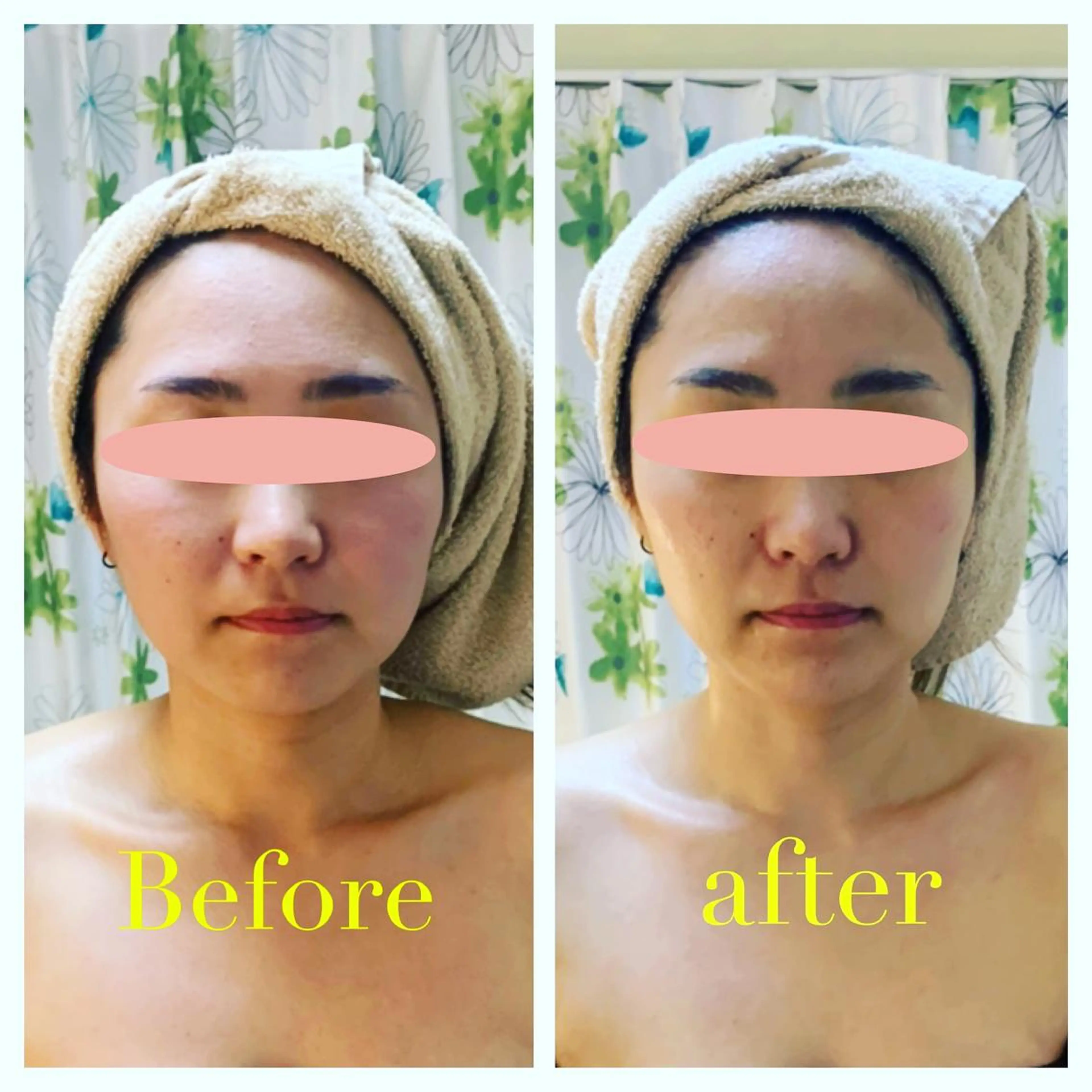 エステ リラク エステティック Nanagiのエステ・リラクイメージ