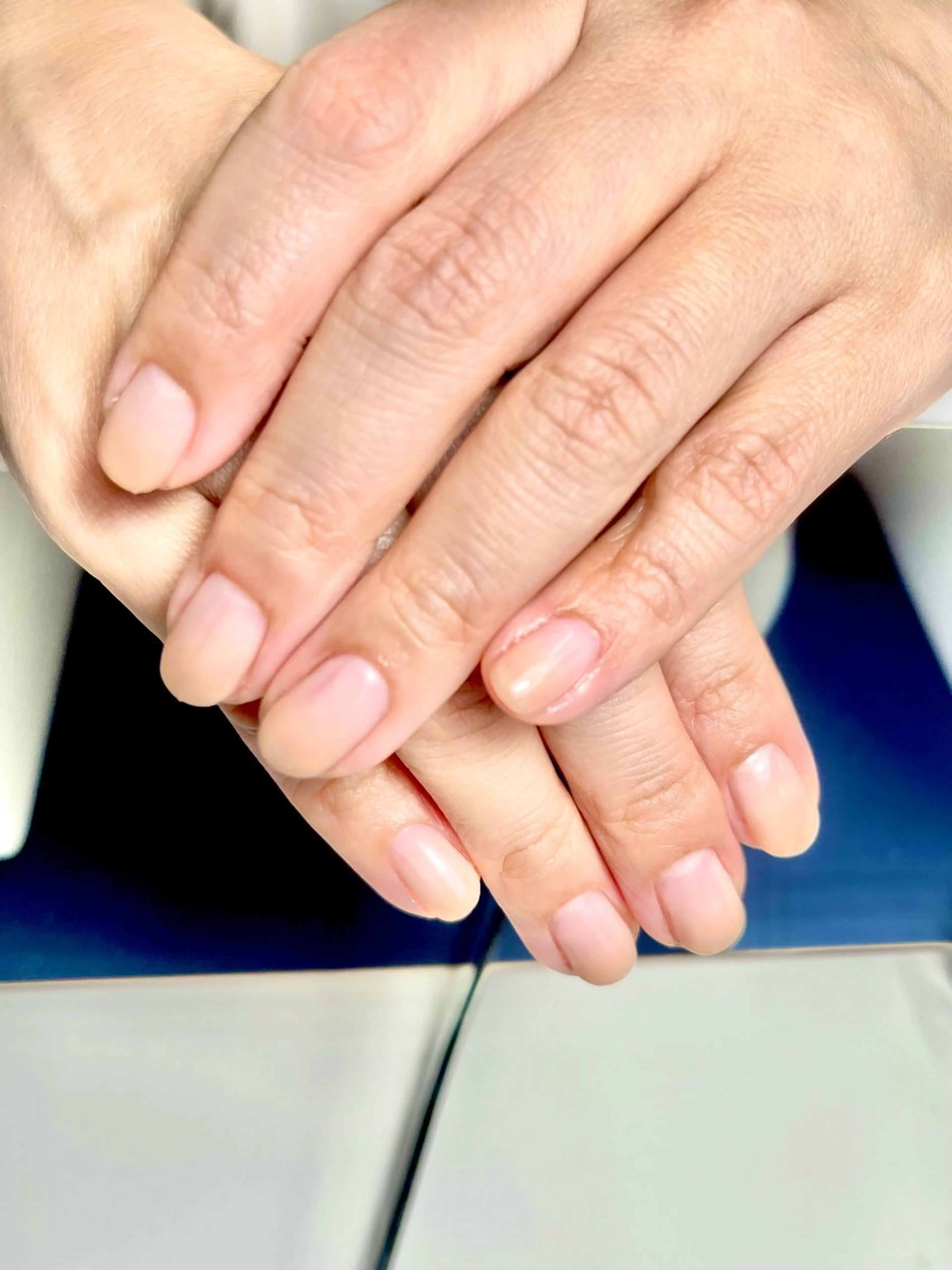 ネイルご利用のお客様限定！指脱毛 足指脱毛に変更も可！の写真