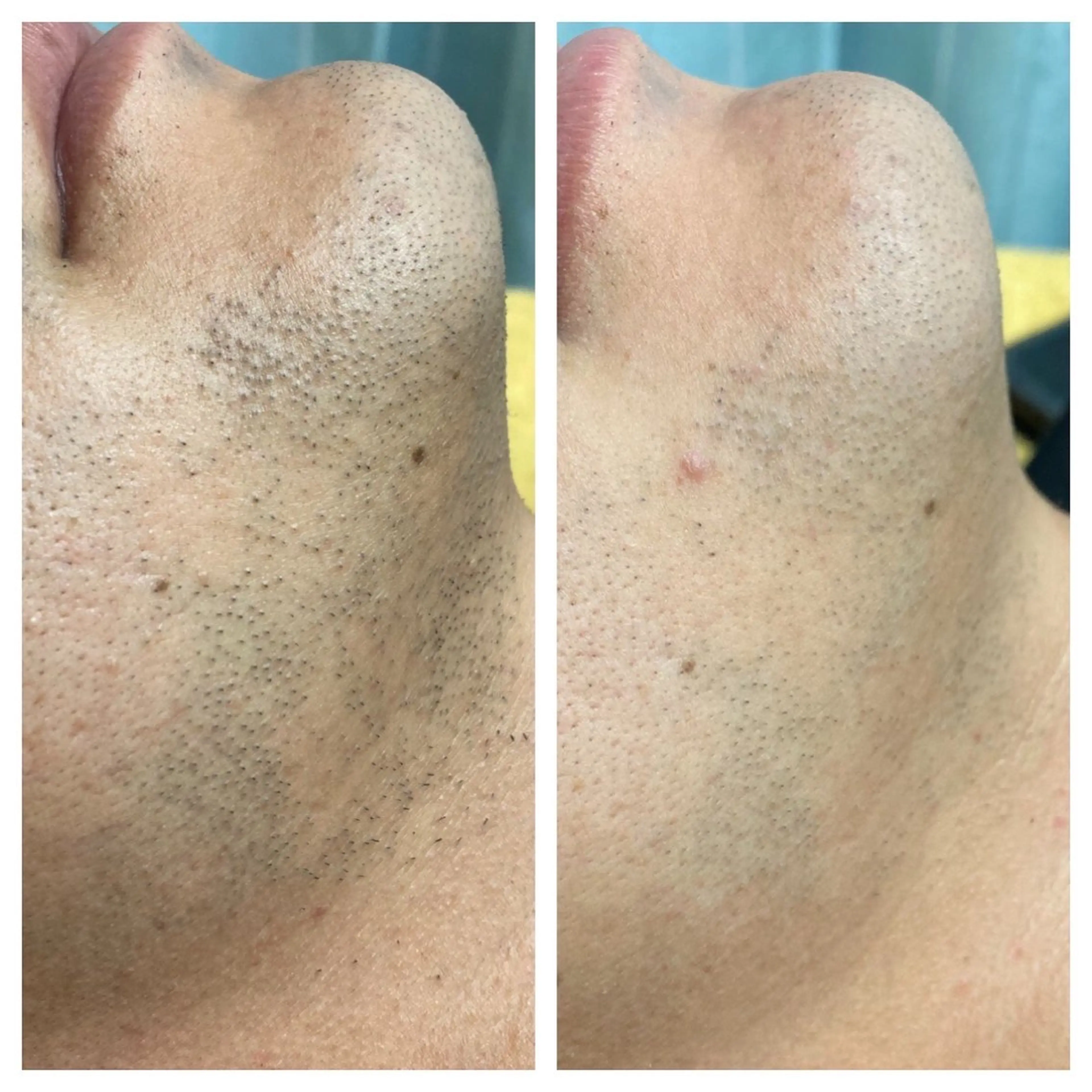 たにがわ整骨院　　salon  de  epila所属・salon   de epilaのエステ・リラクイメージ