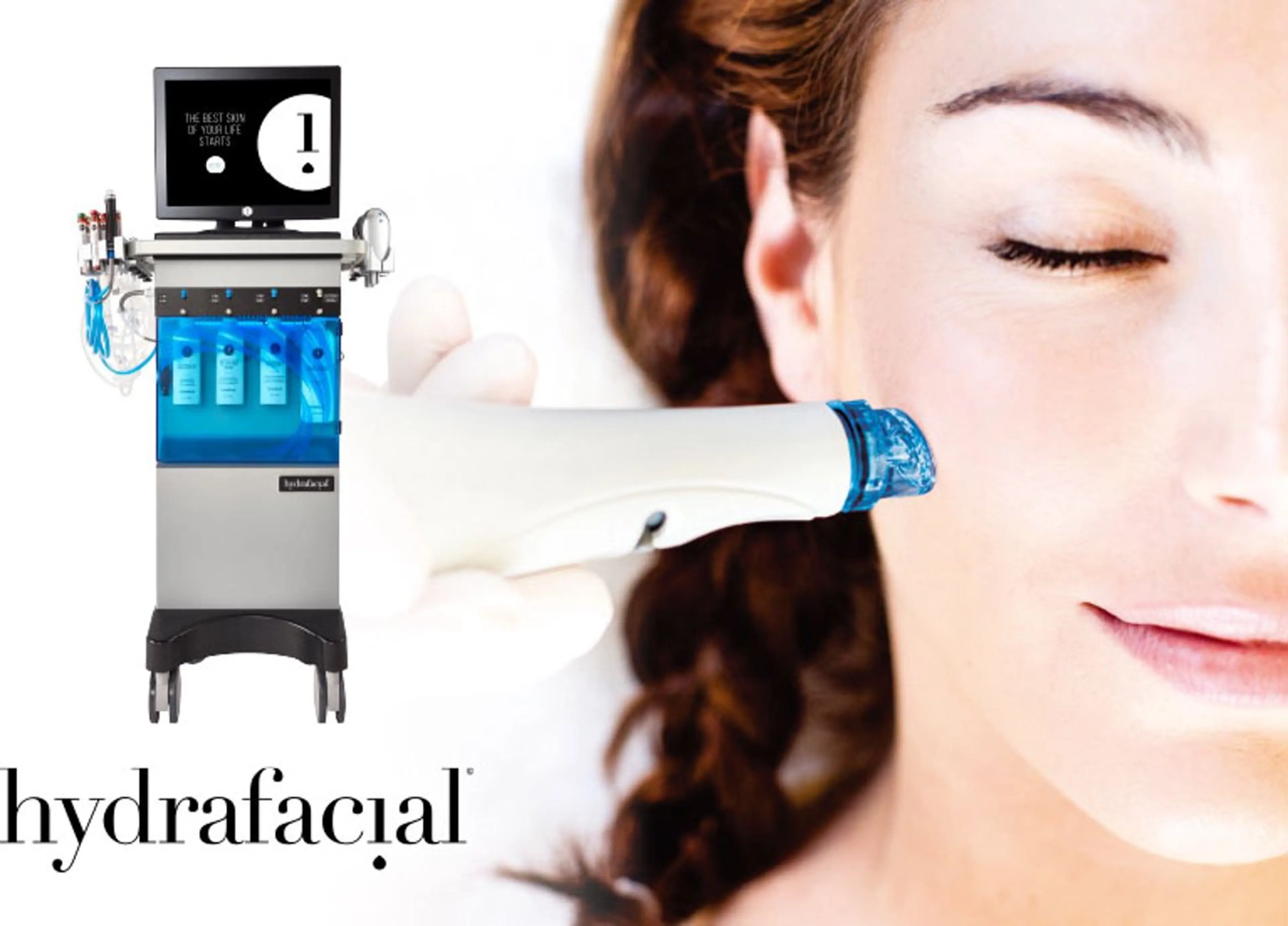 ハイドラフェイシャル➕毛穴エクストラクション＋炭酸ピーリング＋ヒト幹細胞導入の写真