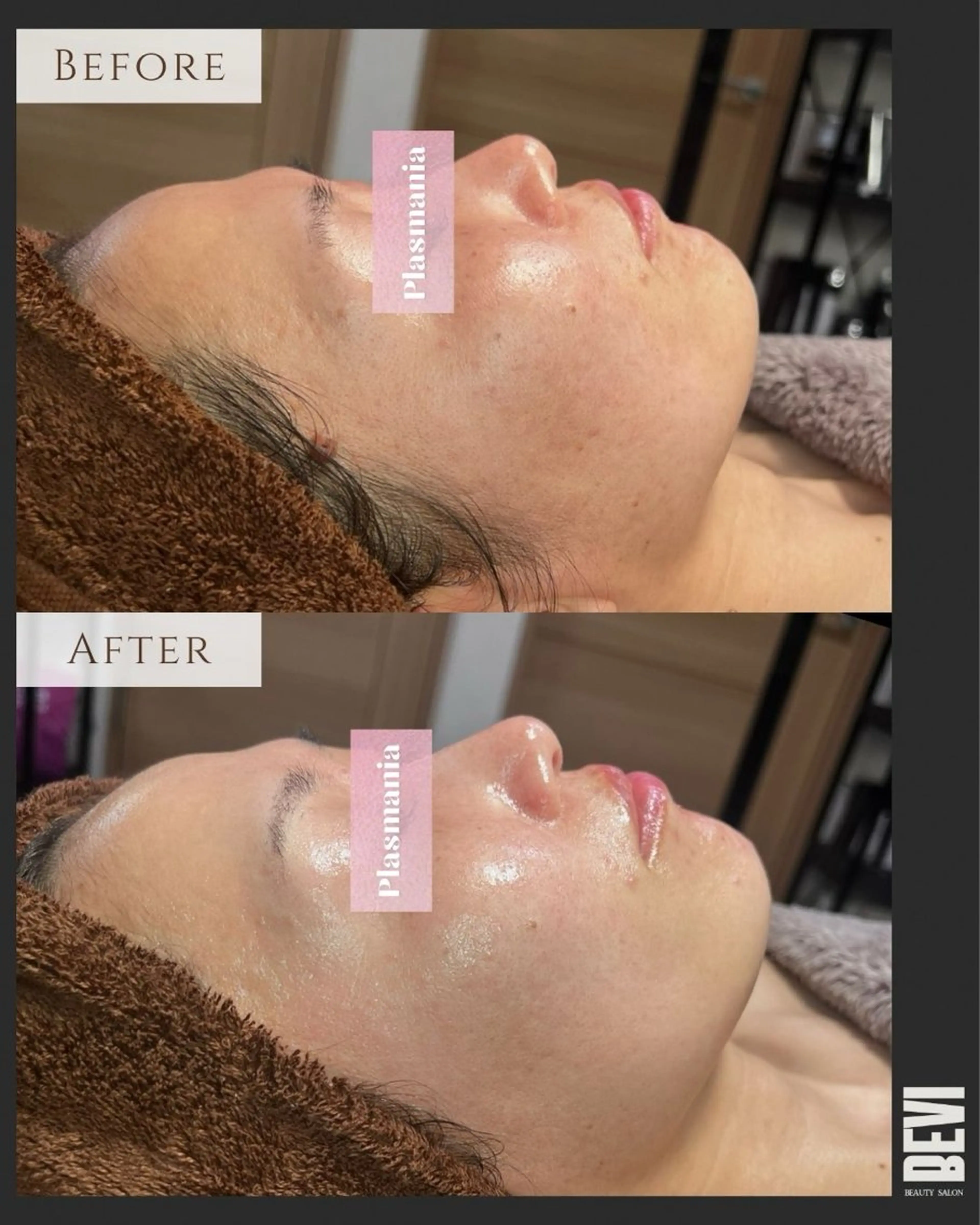 エステ Bevi salonのその他イメージ