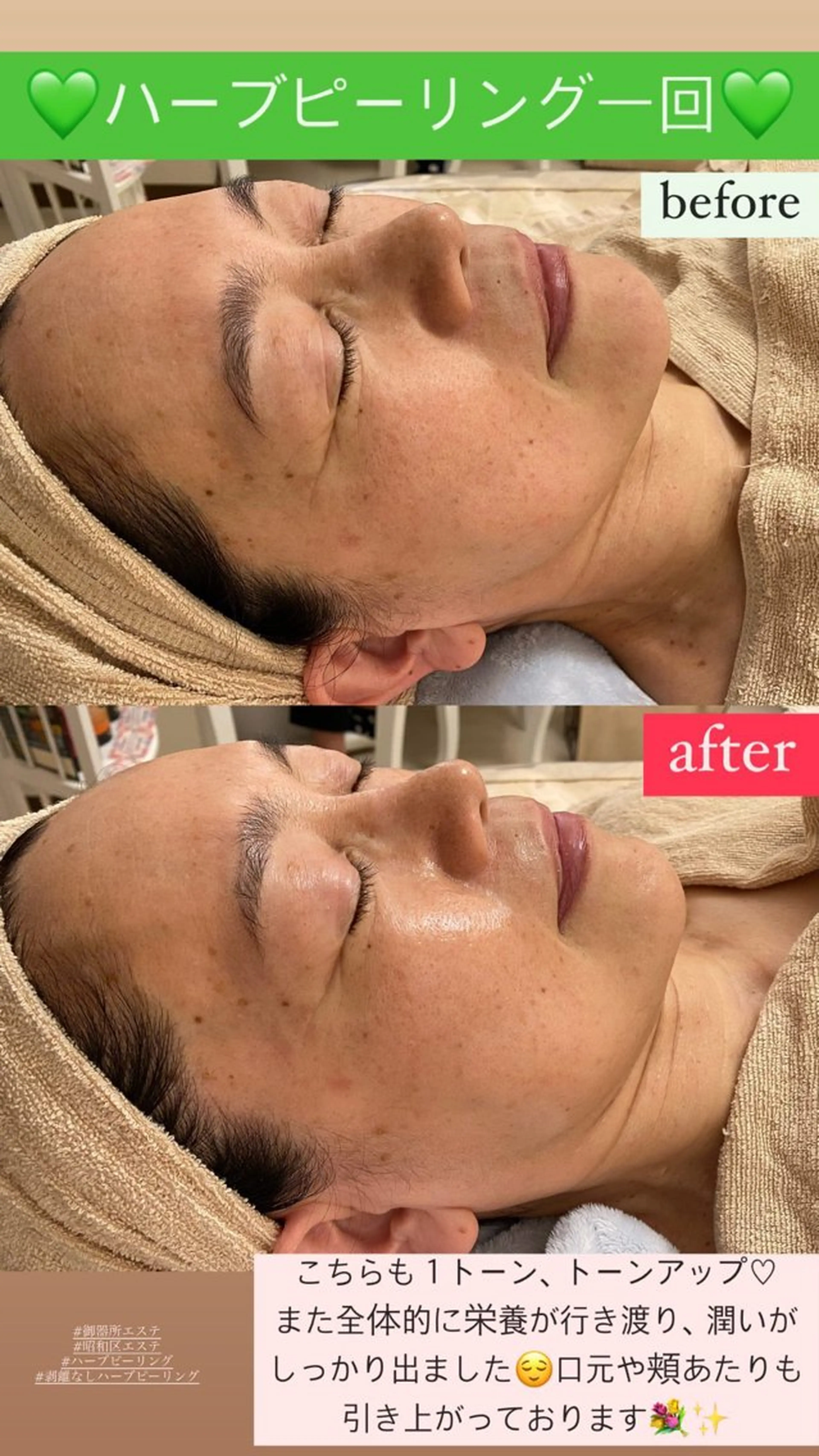 エステ Salon de Lino 御器所のエステ・リラクイメージ