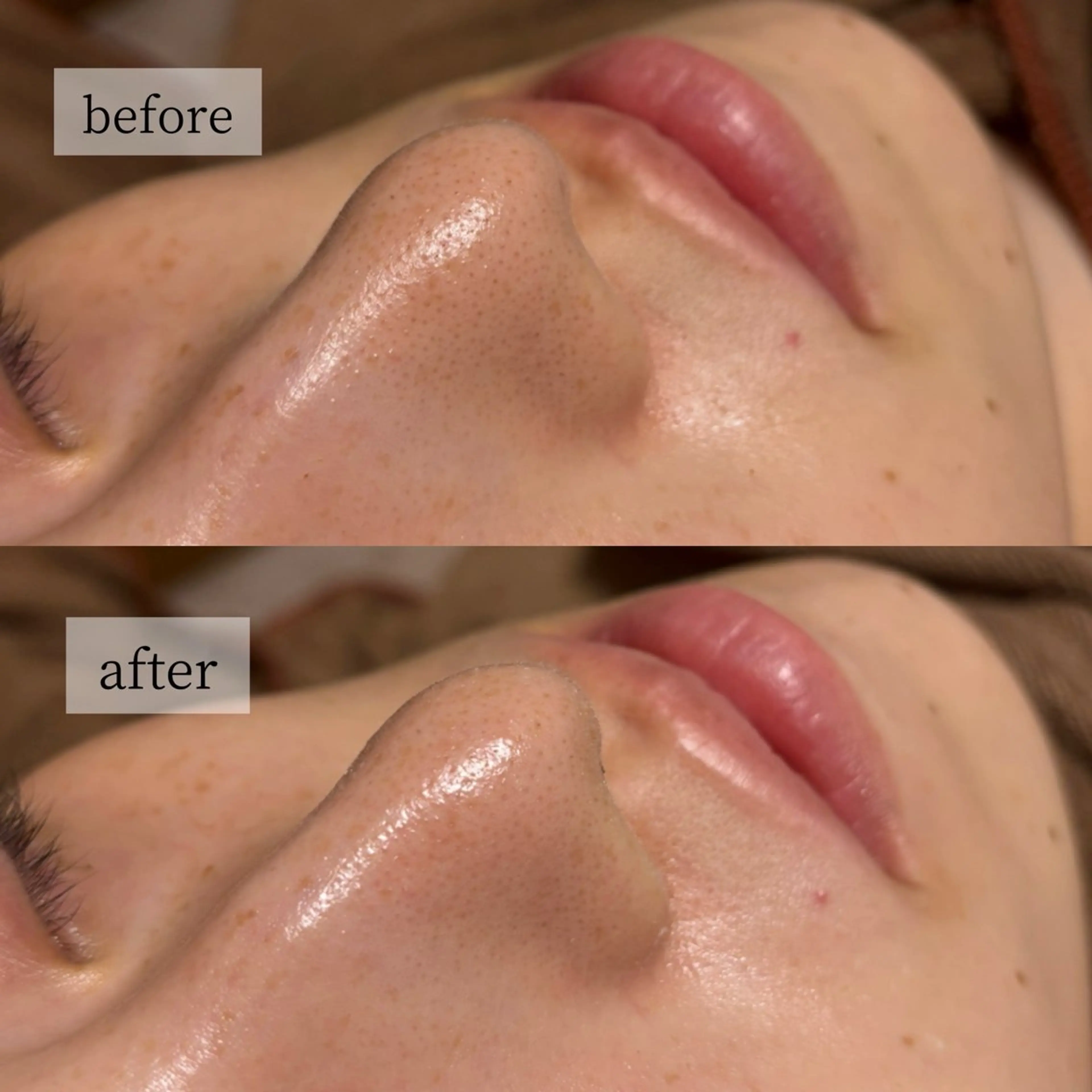 エステ HINANO矢場町店【ヒナノ】所属・脱毛/肌改善🌿 HINANO 村田のエステ・リラクイメージ